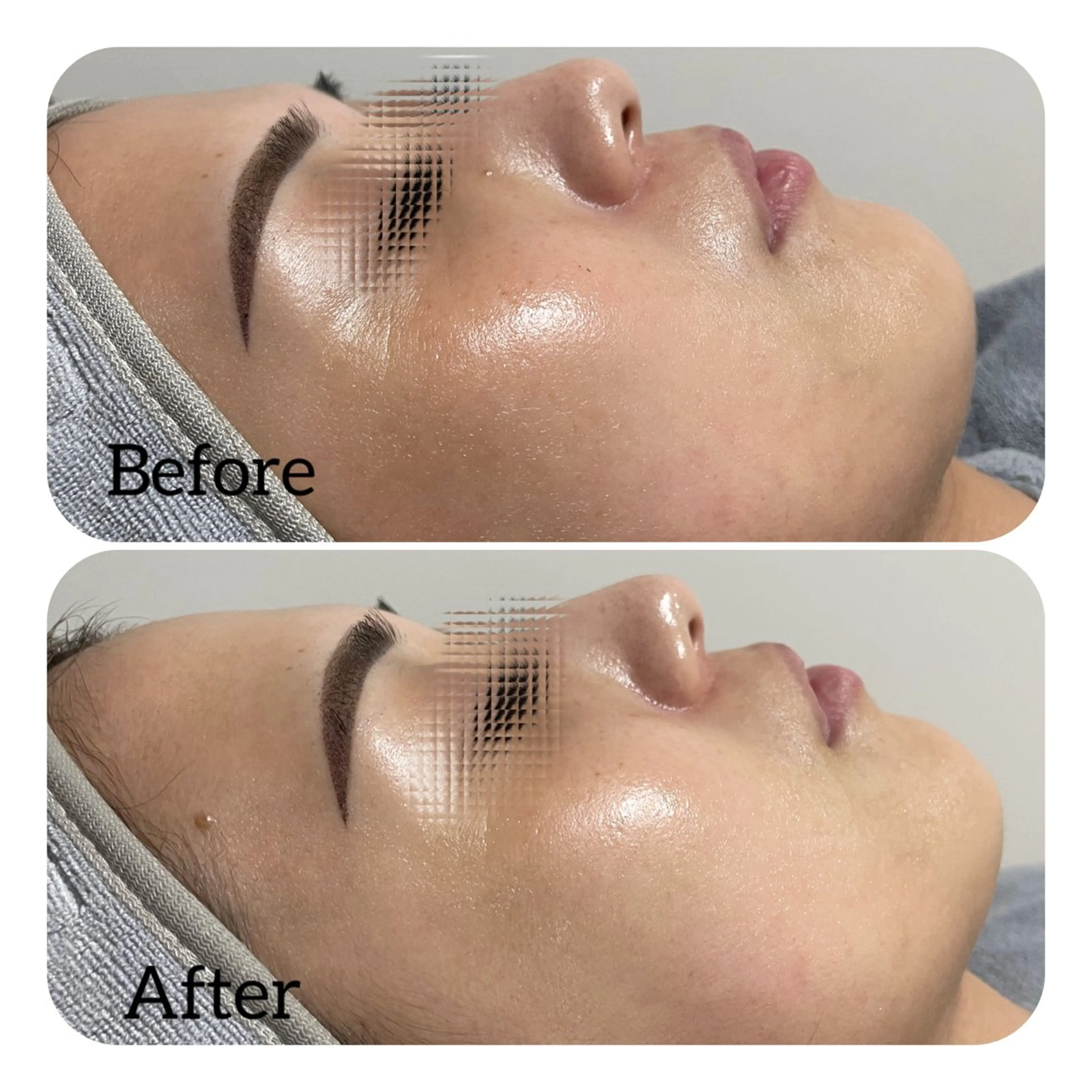 エステ Éclat de Belle🫧白玉肌のエステ・リラクイメージ