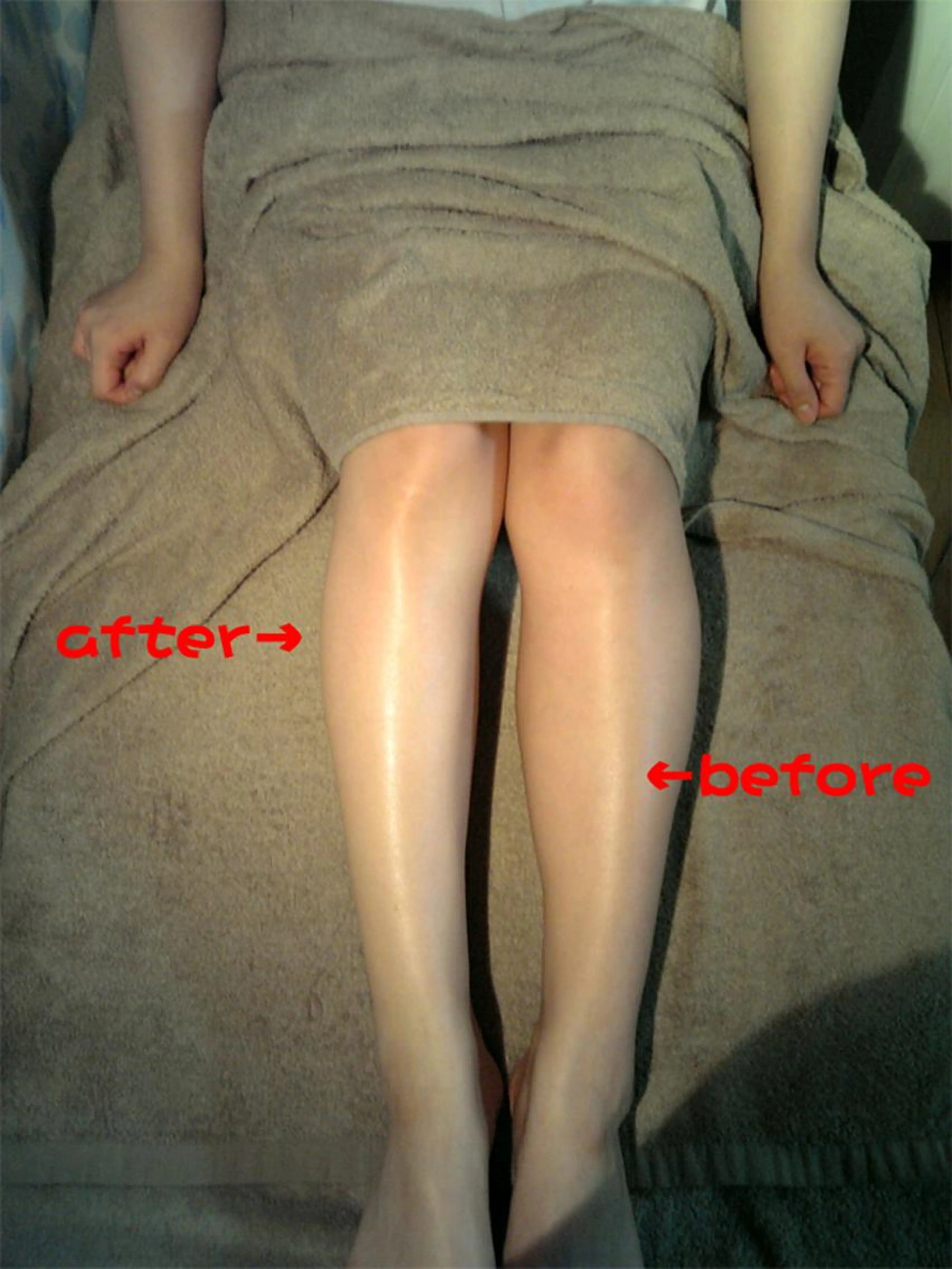 <B都度払+無勧誘>セルライトケア+O脚矯正+EMS筋トレ=135分25,300→8800の写真
