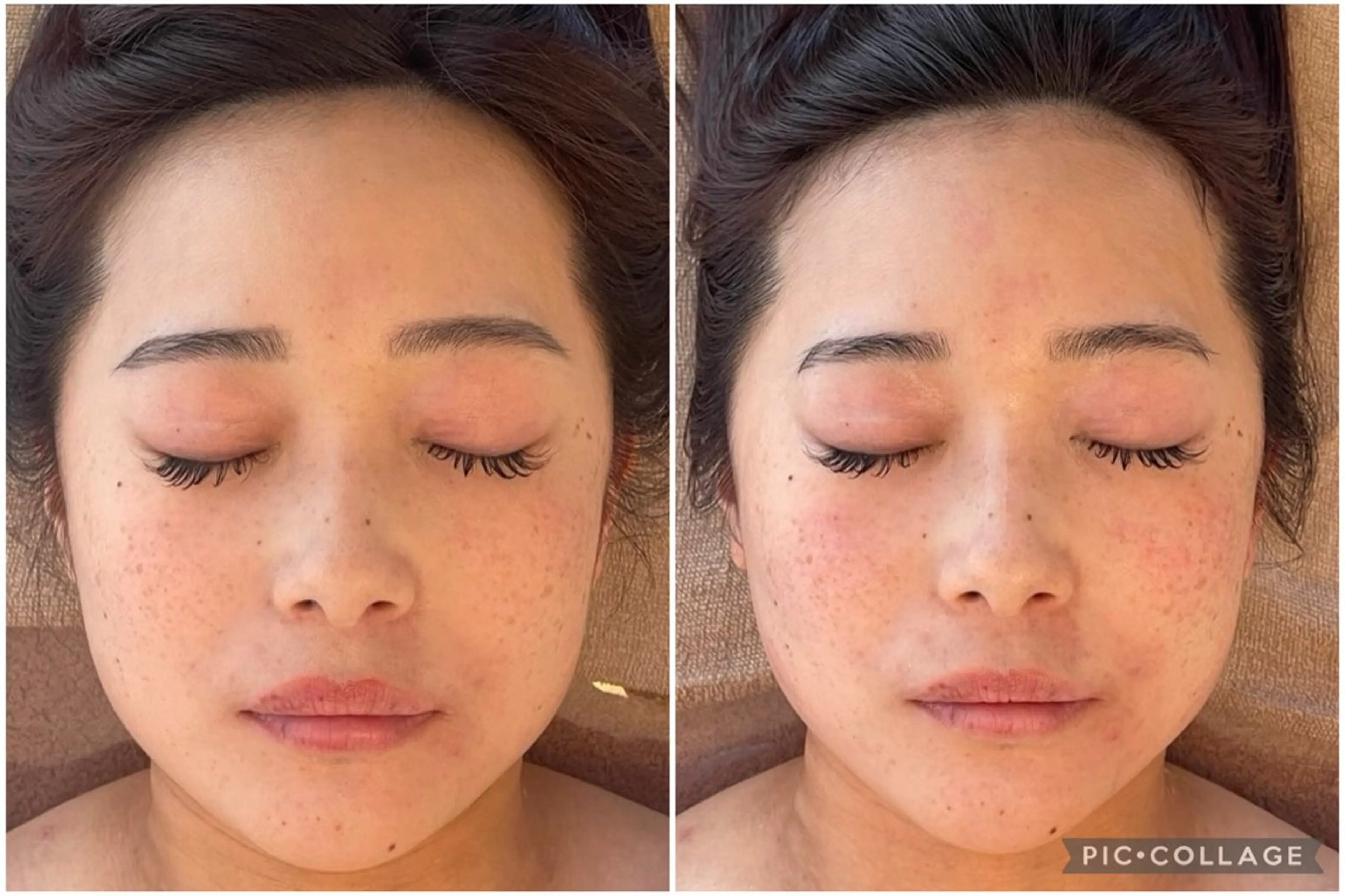 平日限定🙌🏻小顔矯正コルギ＋上半身ほぐし付🉐韓国アイドル顔🇰🇷《残り枠数わずか！！》の写真