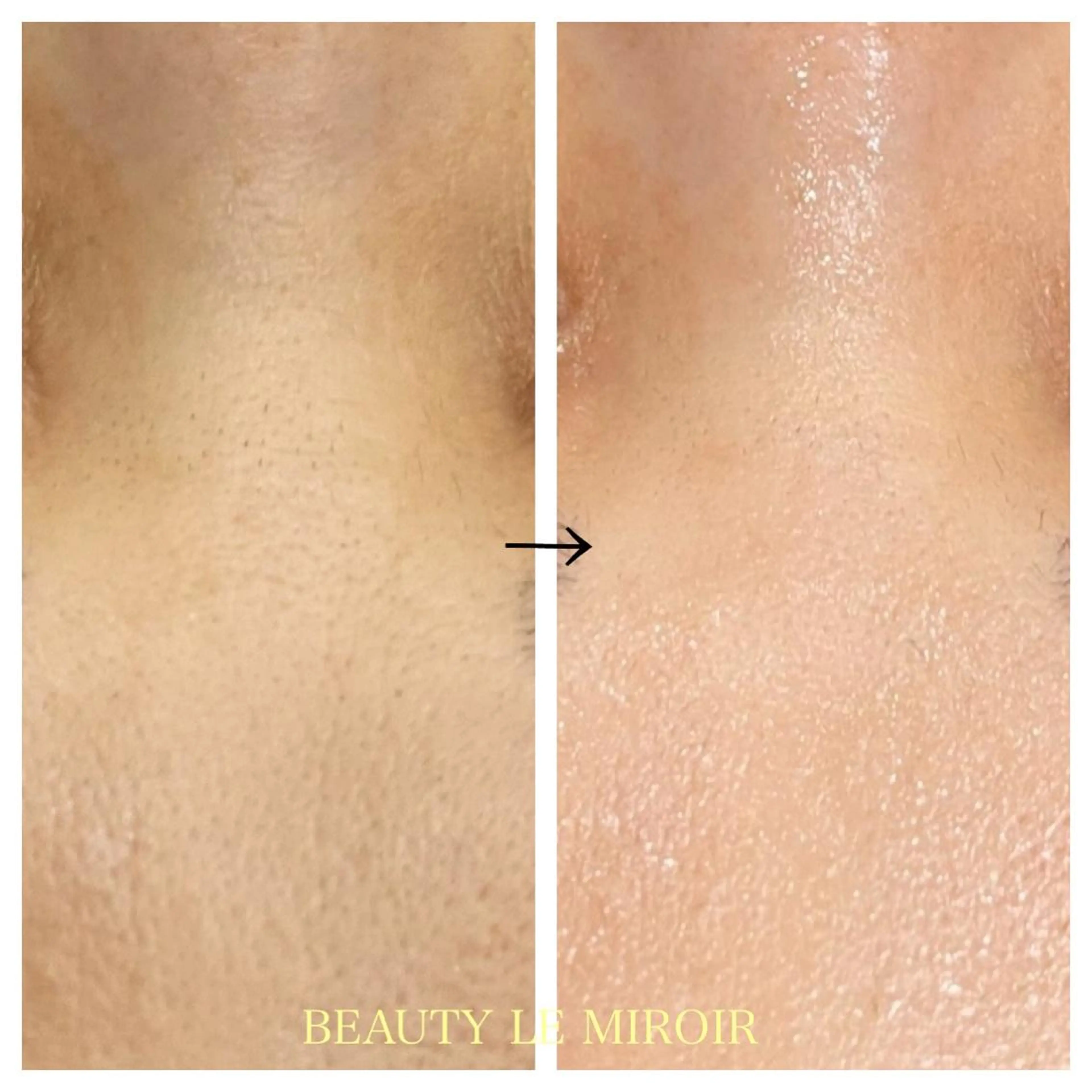 ビューティー ミロワールのエステ・リラクイメージ