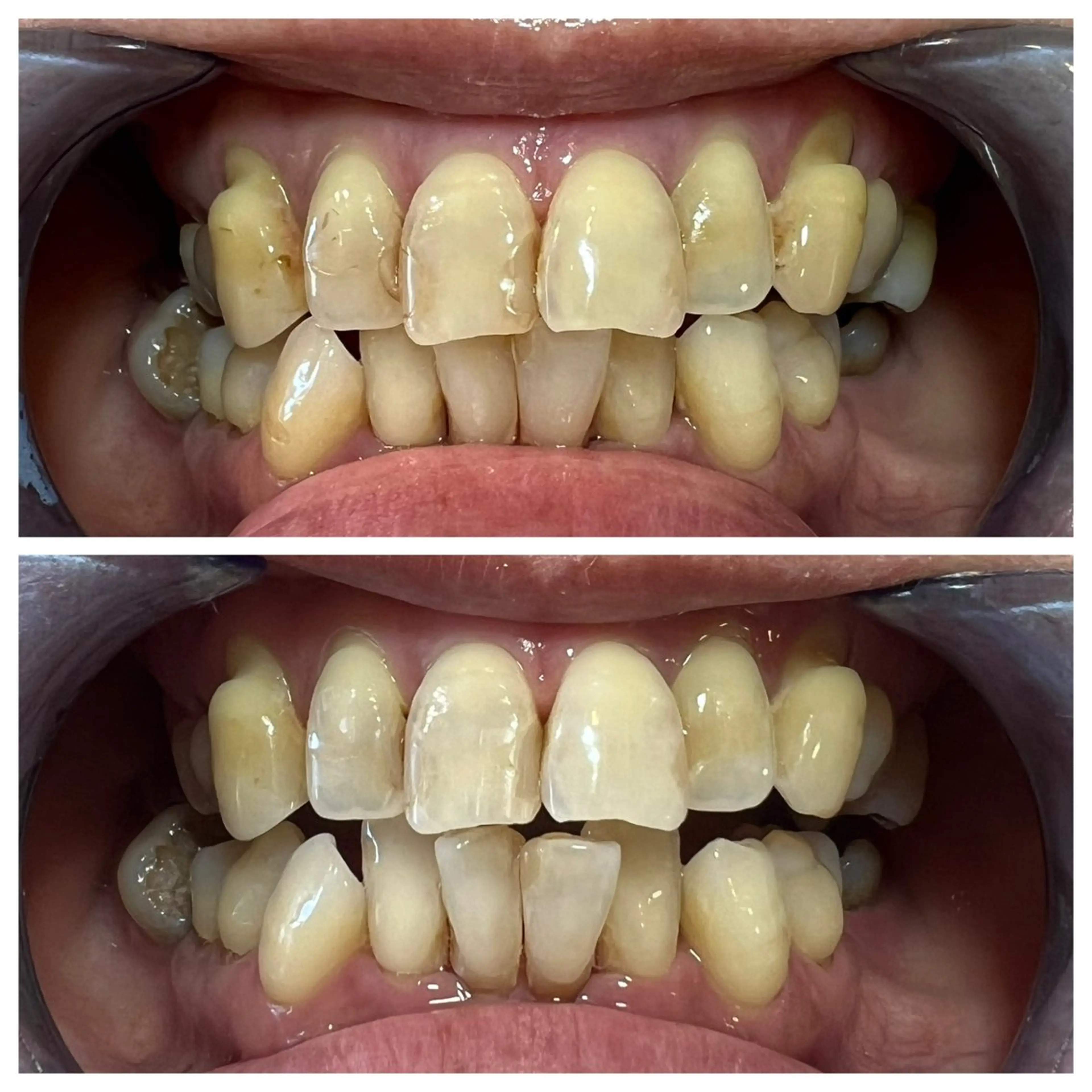 セルフホワイトニング Shineeのエステ・リラクイメージ