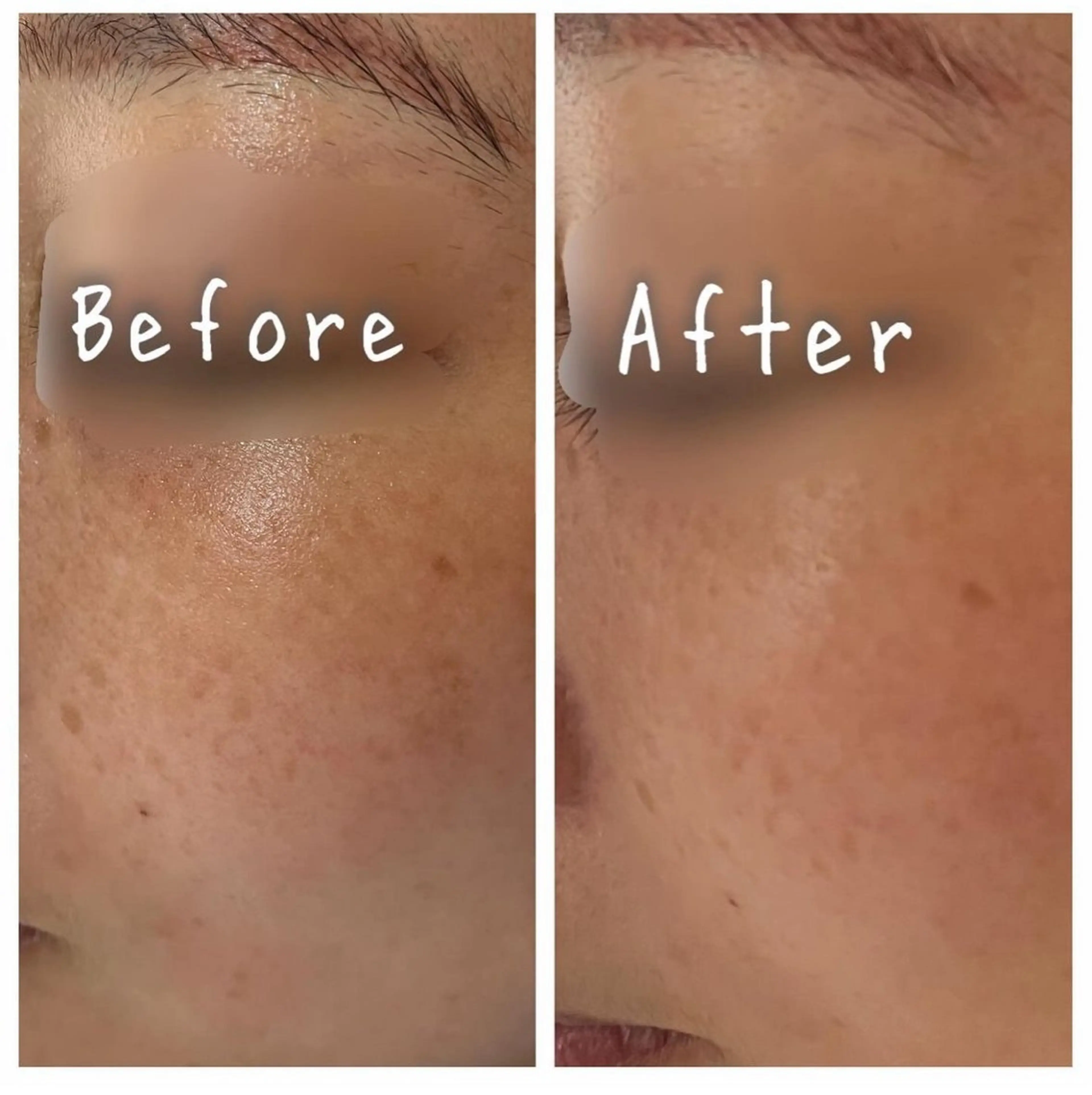 ナスサロ nozomiのエステ・リラクイメージ