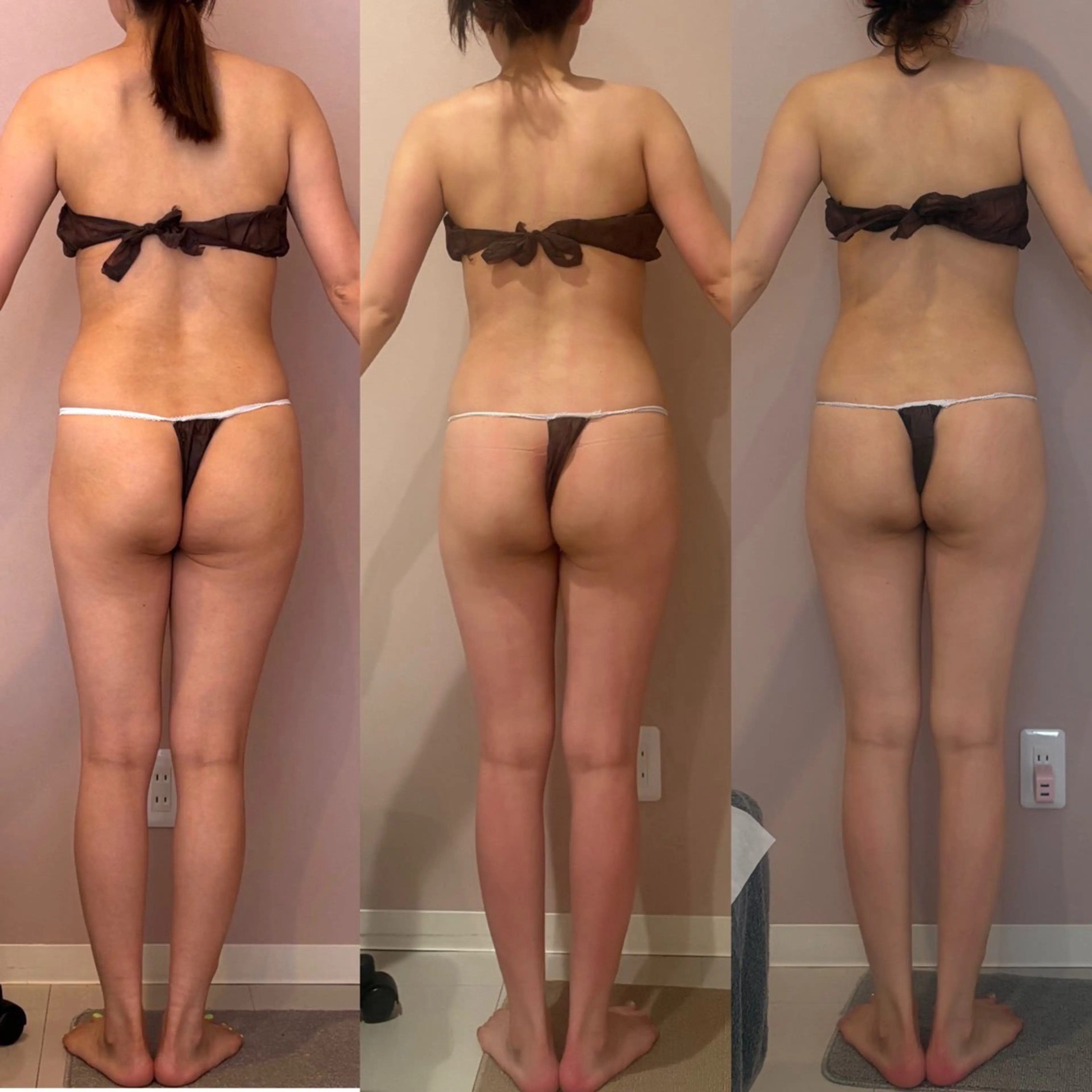 【肩凝り/浮腫み/後ろ姿別人級✨】肩甲骨剥がし+姿勢矯正エステの写真