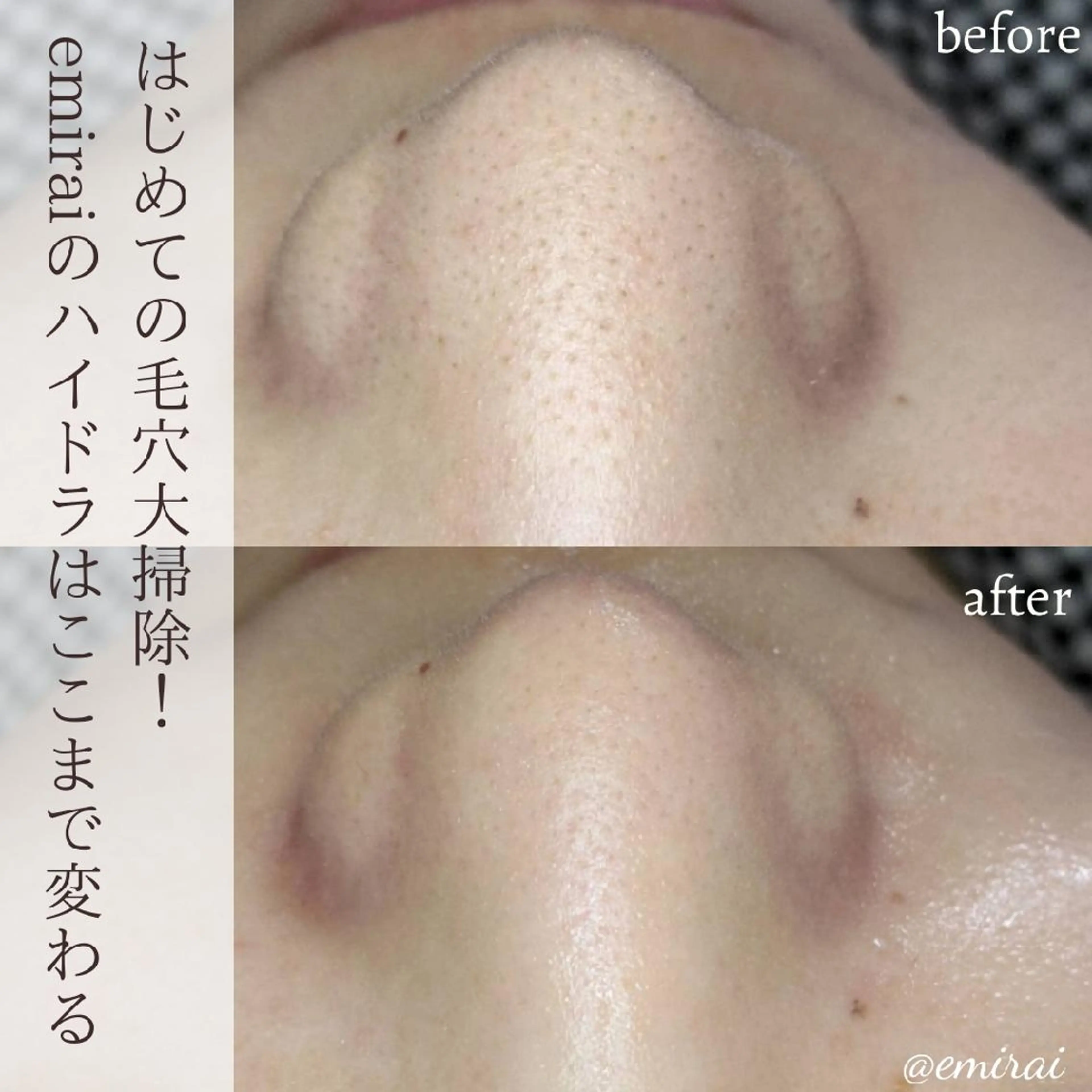 🌿emirai SEN🌿のエステ・リラクイメージ