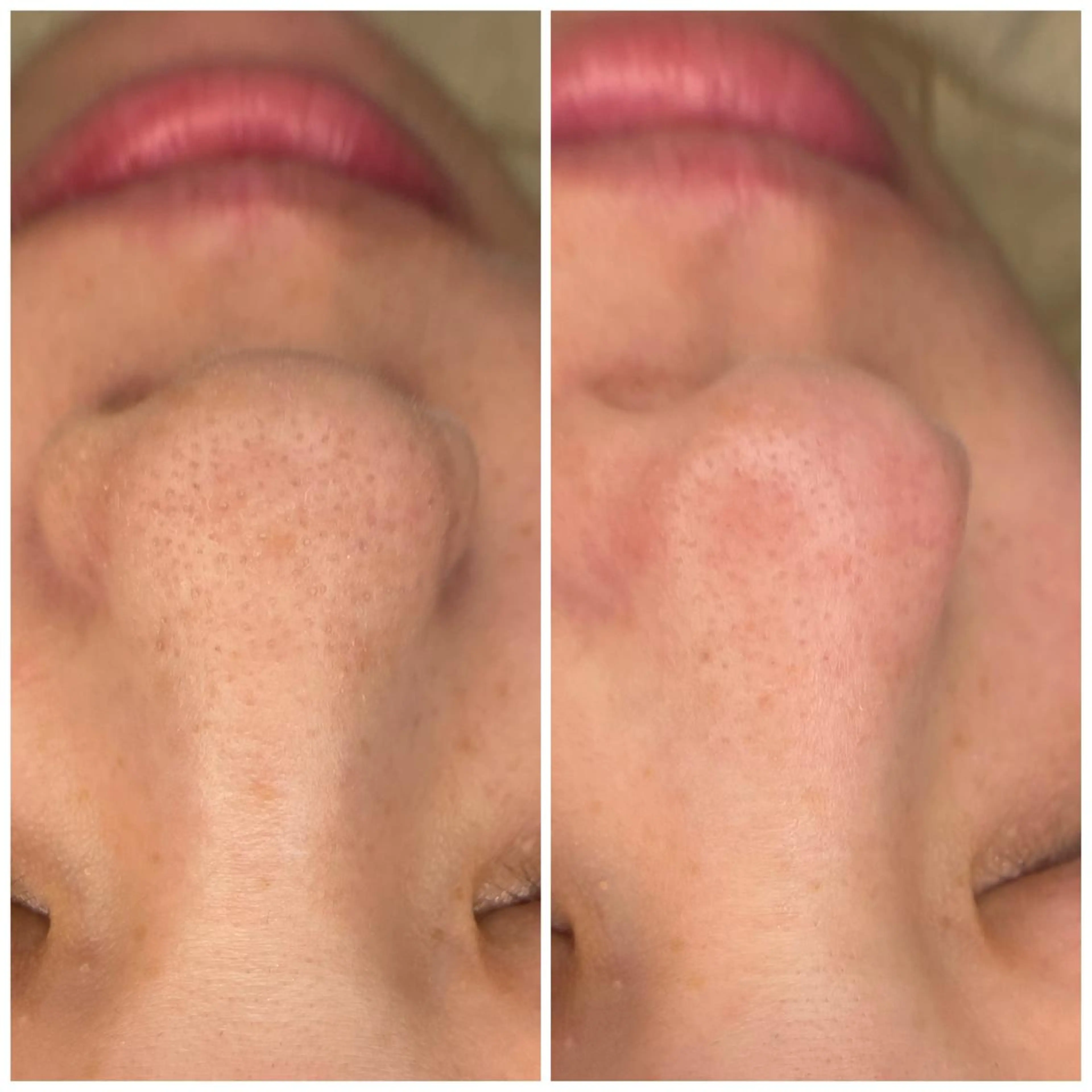 エステ É LINDA所属・E LINDAのネイルデザイン