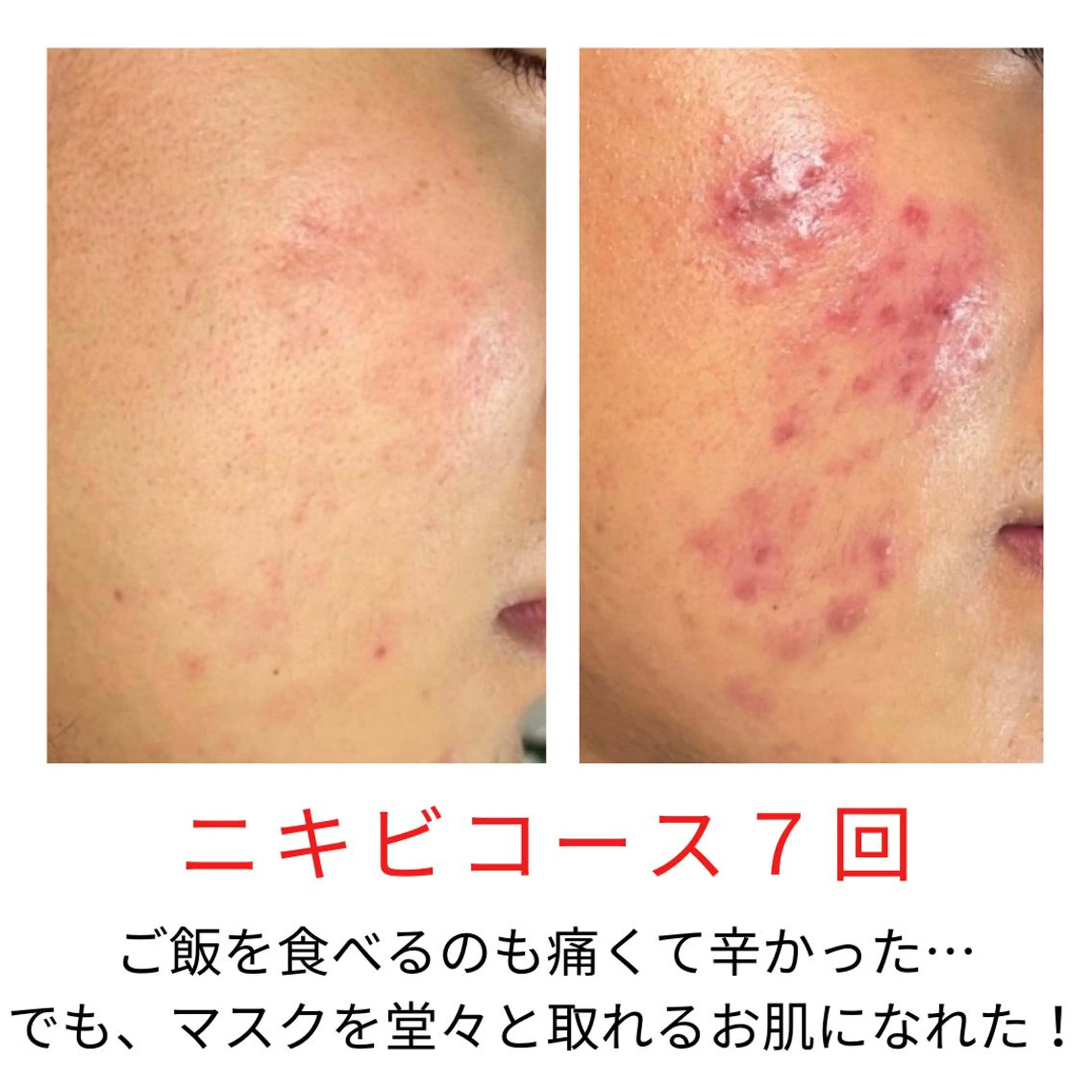 エステ ベラージュ【美背中・ 美尻・フェイシャル】のエステ・リラクイメージ