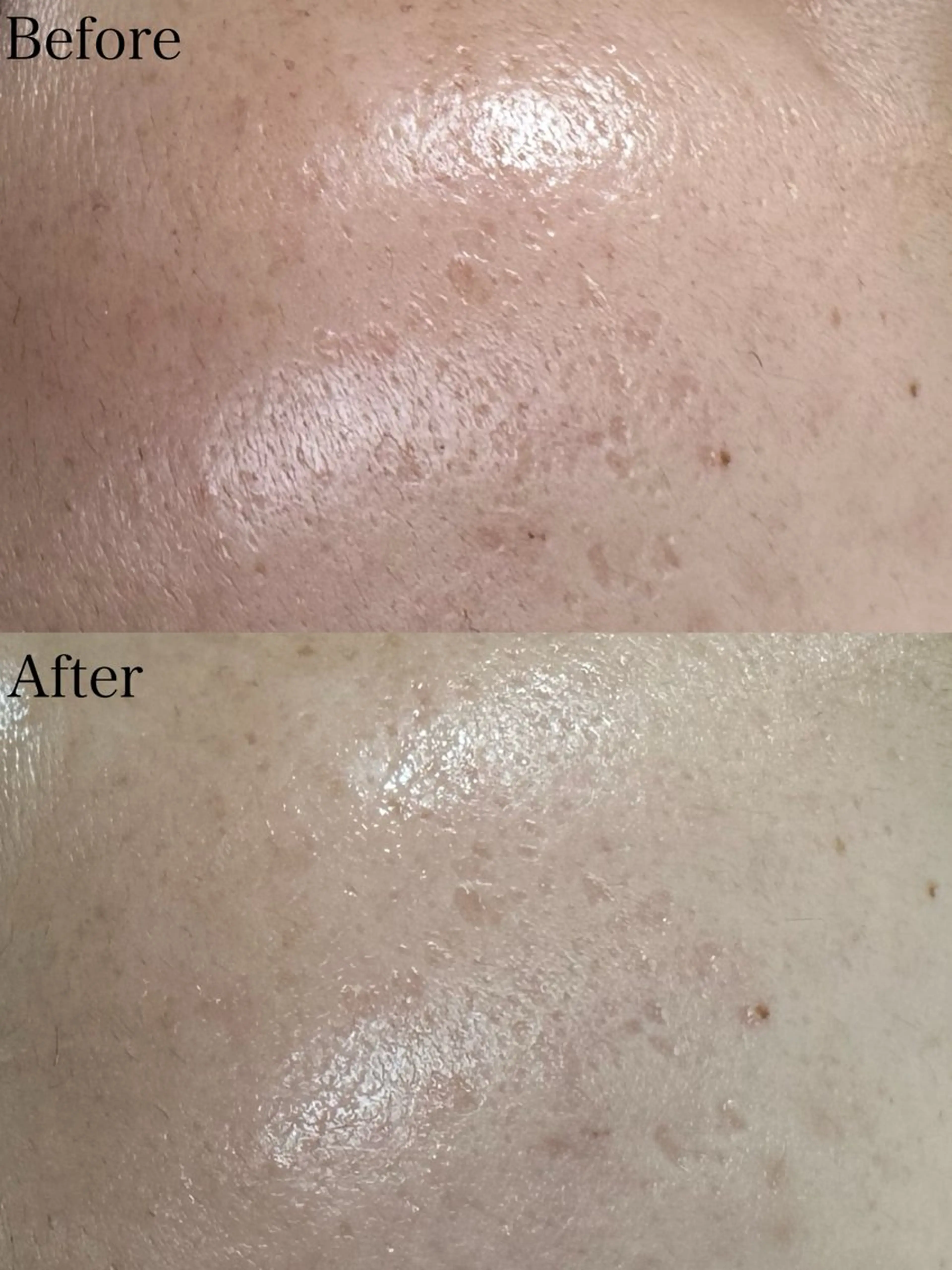 エステ beautysalon LIMOA所属・松本 愛絵理のエステ・リラクイメージ