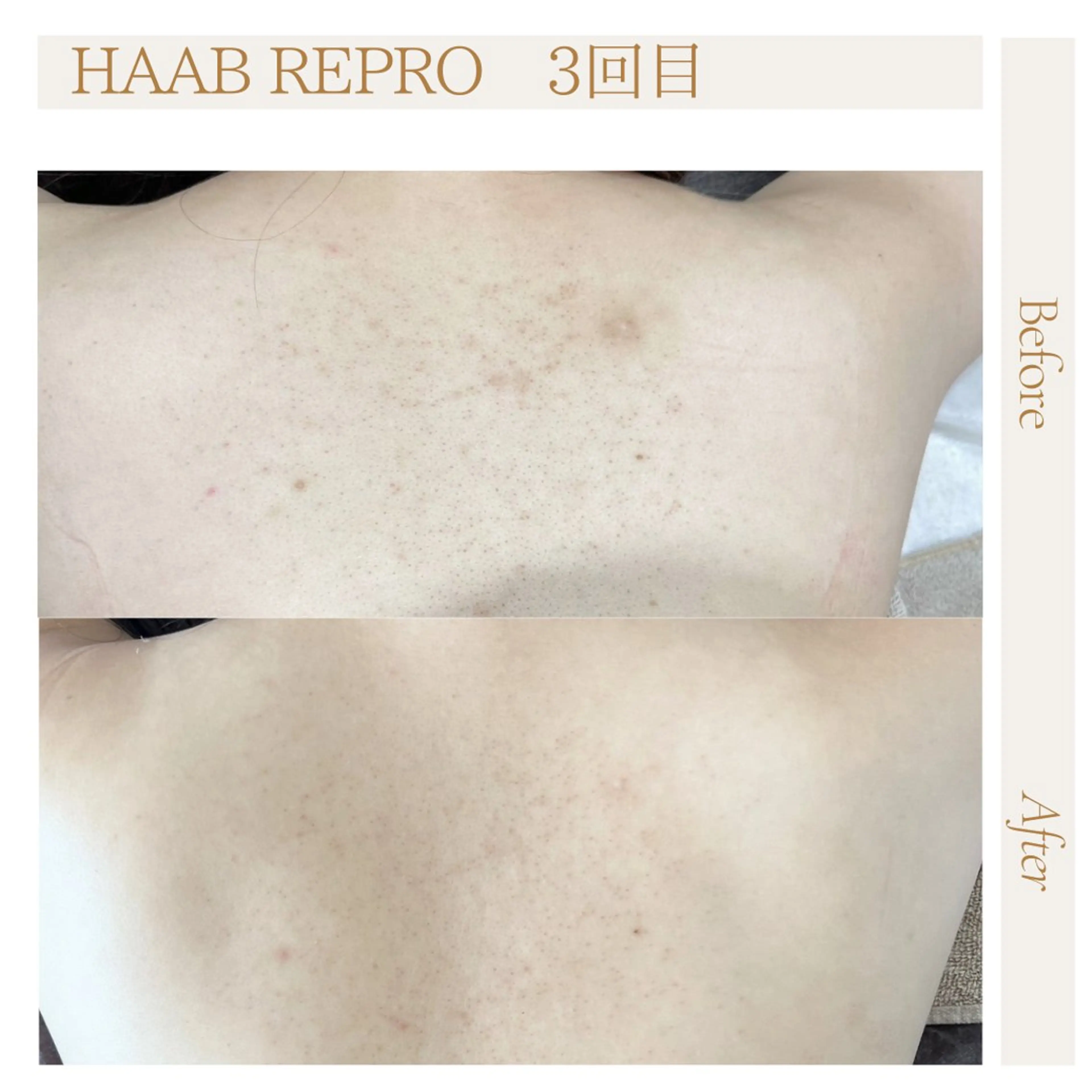 肌管理サロン neoriiのその他イメージ