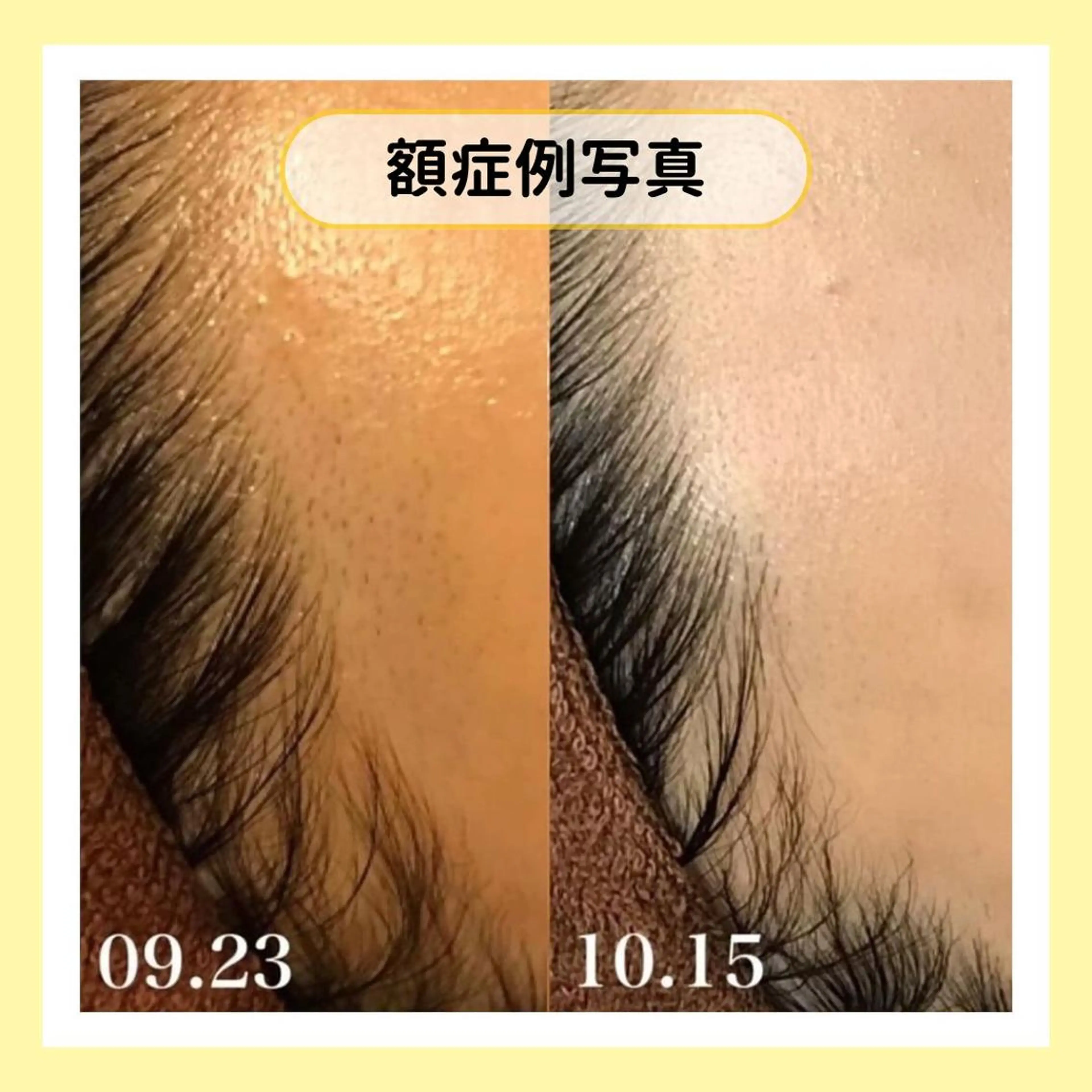 金山/脱毛/美肌 ULULUのエステ・リラクイメージ