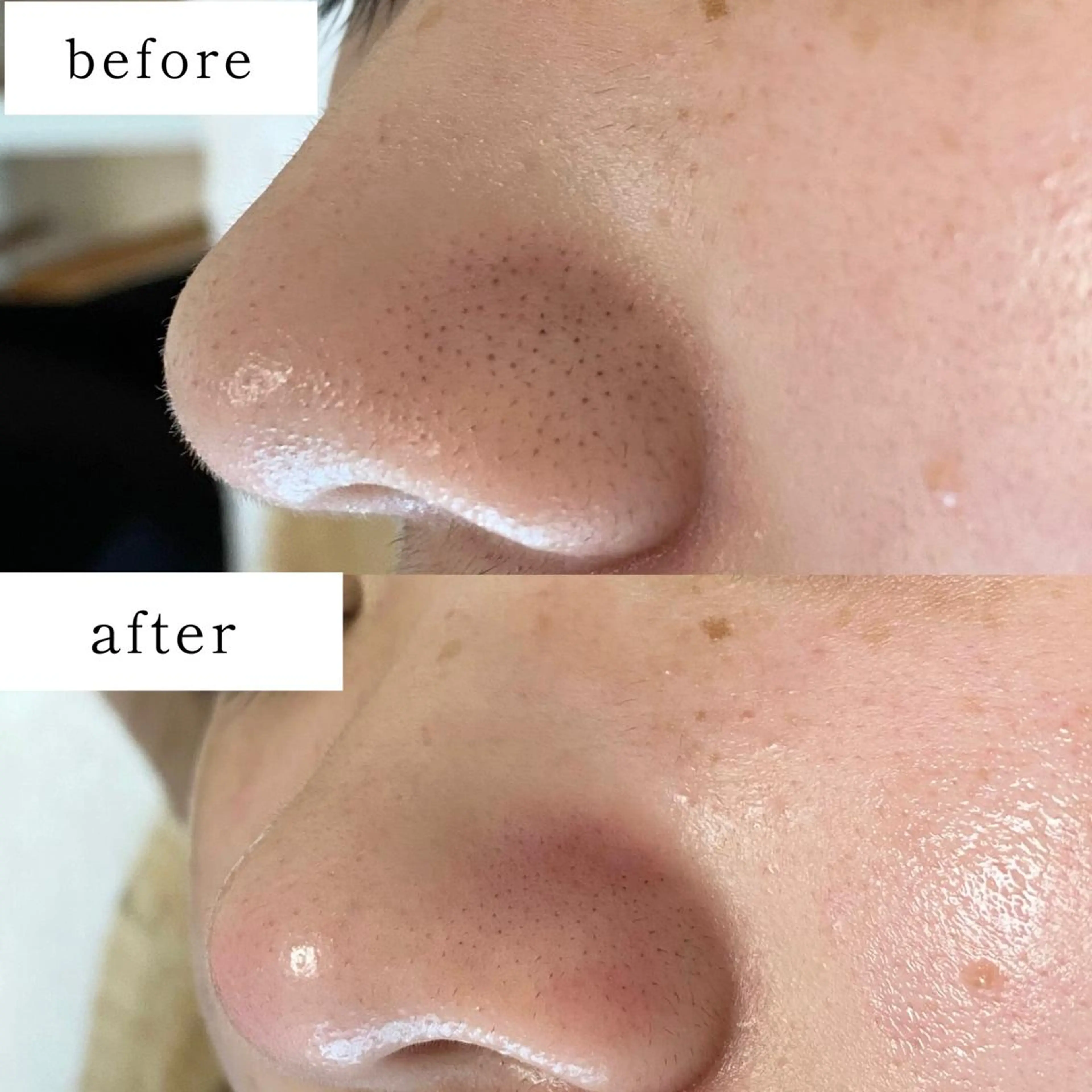 毛穴専門サロン　フルール所属・フルールFululu 自由が丘のエステ・リラクイメージ