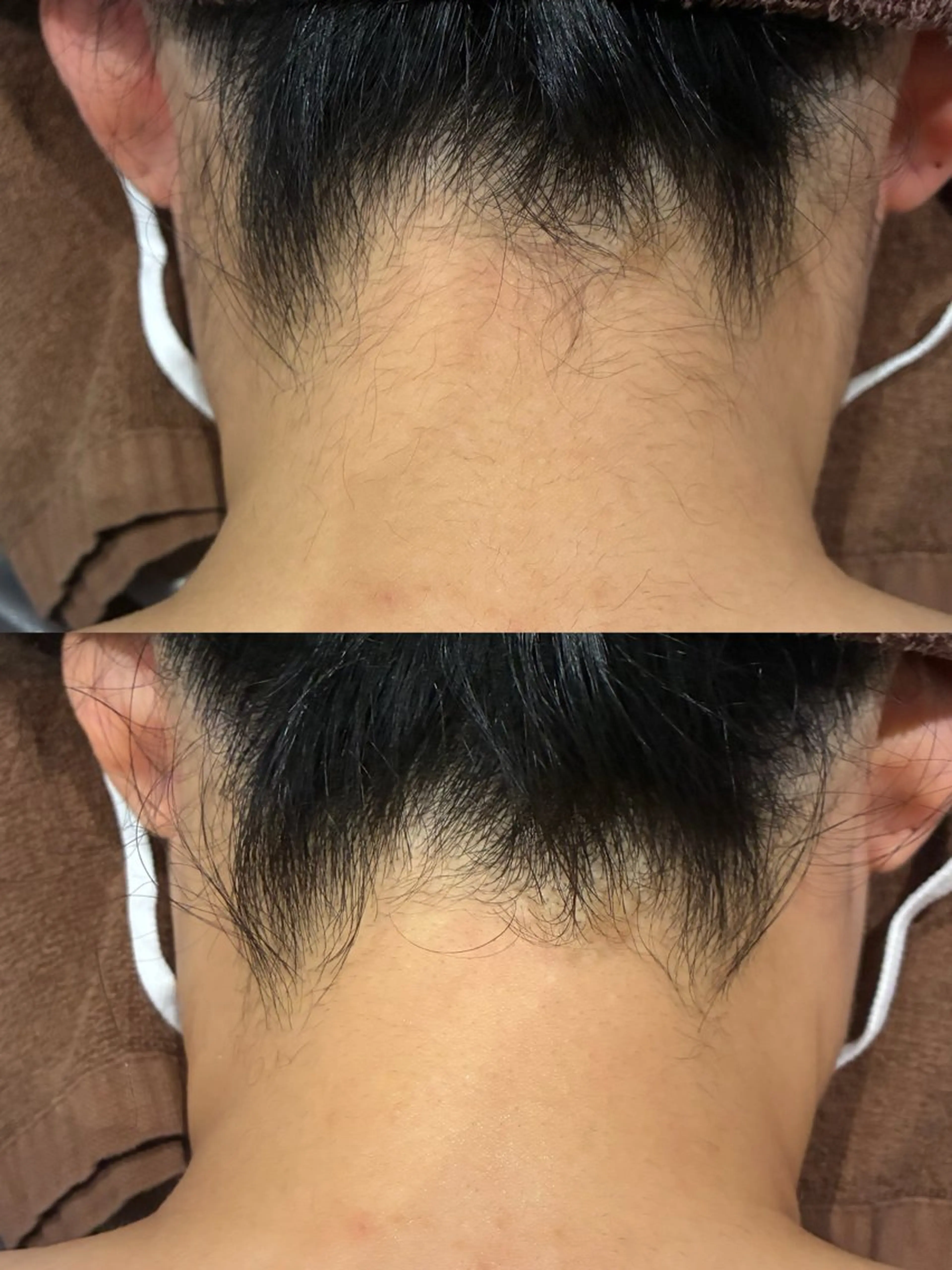 脱毛 DahliaBeauty ダリアビューティー所属・DahliaBeau tyフェイシャル中村のエステ・リラクイメージ