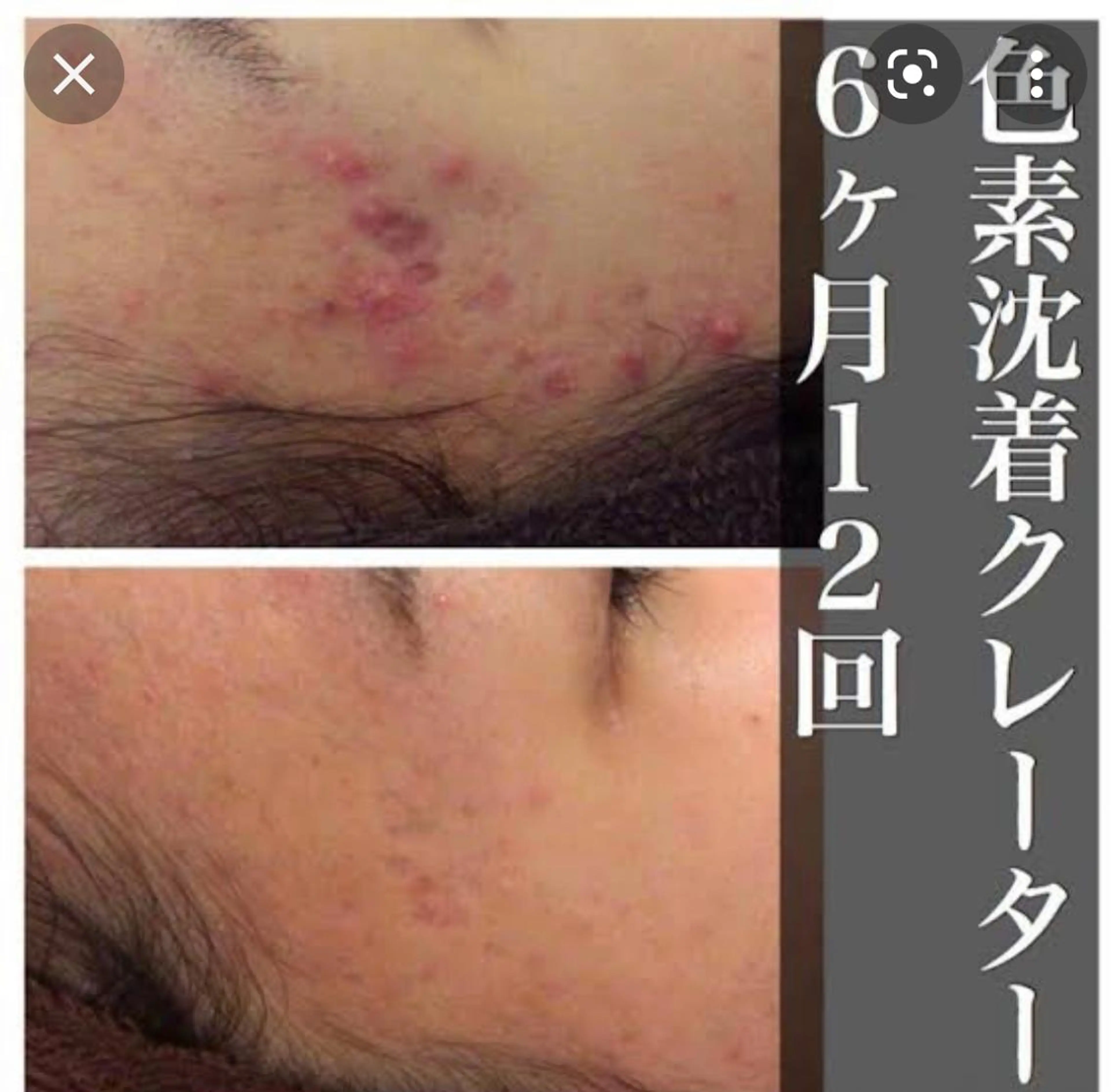 beauty salon epのエステ・リラクイメージ