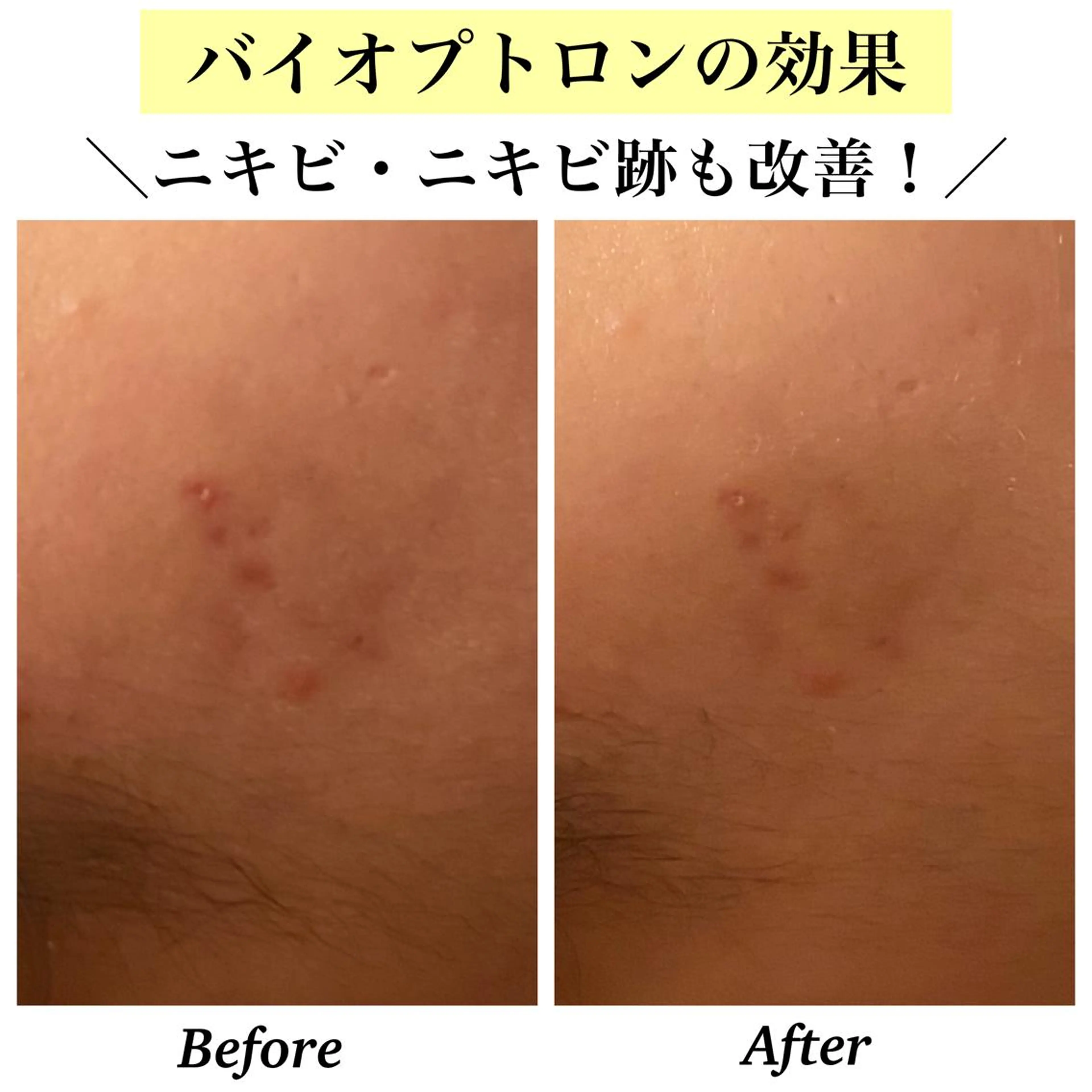 エステ リラク Bellesthe （ベルエステ）のエステ・リラクイメージ