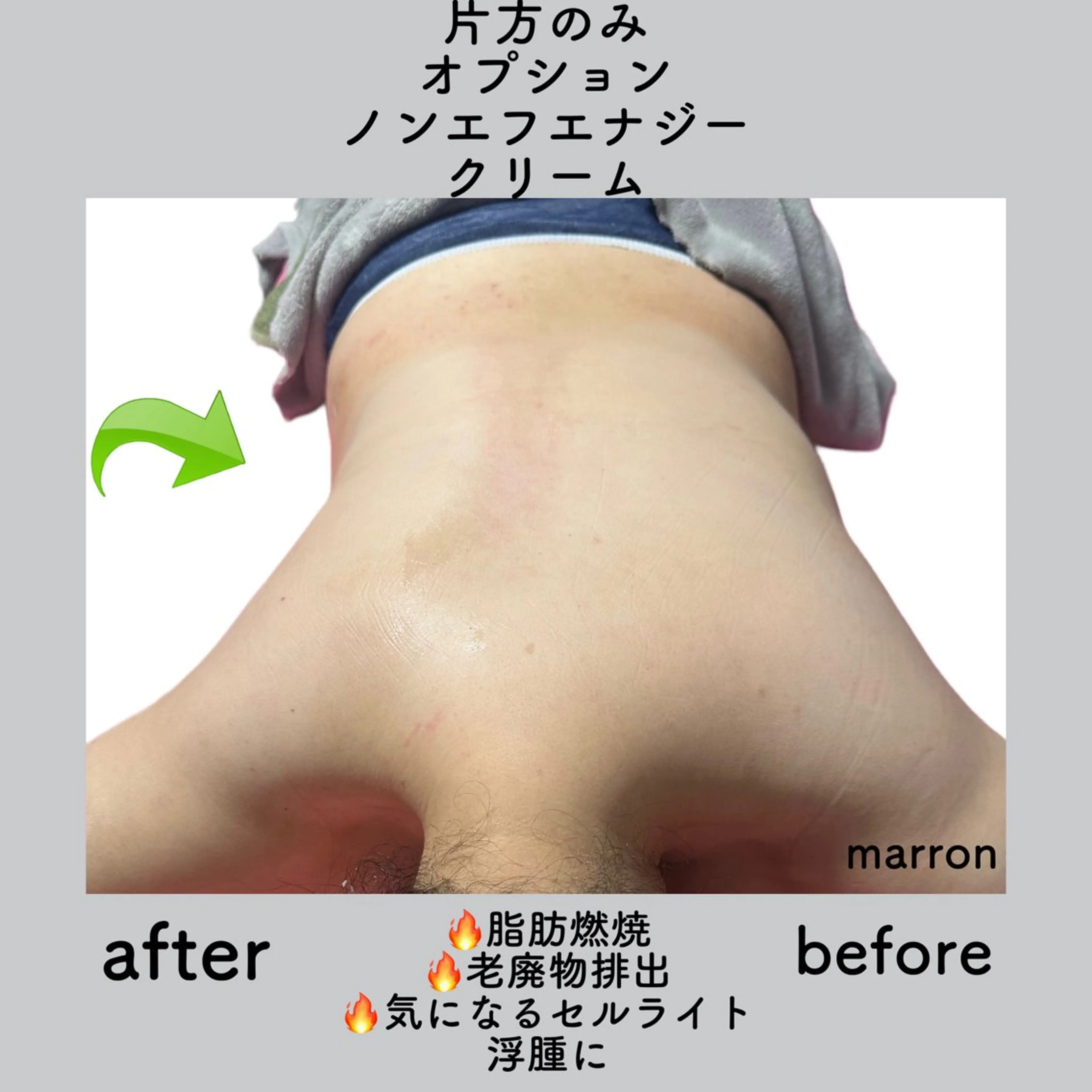 marron所属・痩身ハイパーナイフ ララピールリアボーテのエステ・リラクイメージ