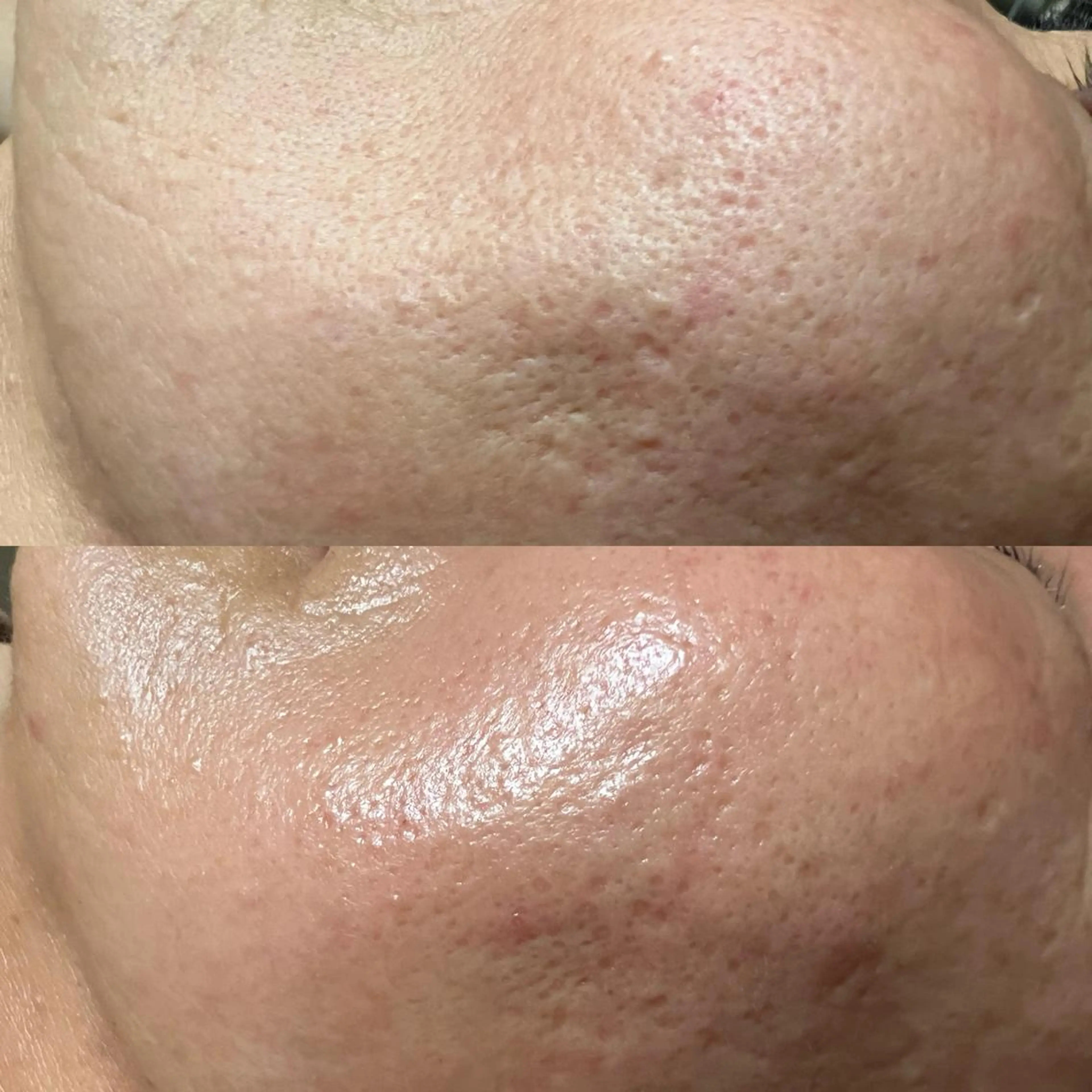 エステ リラク lymph care 'Welnəsのエステ・リラクイメージ