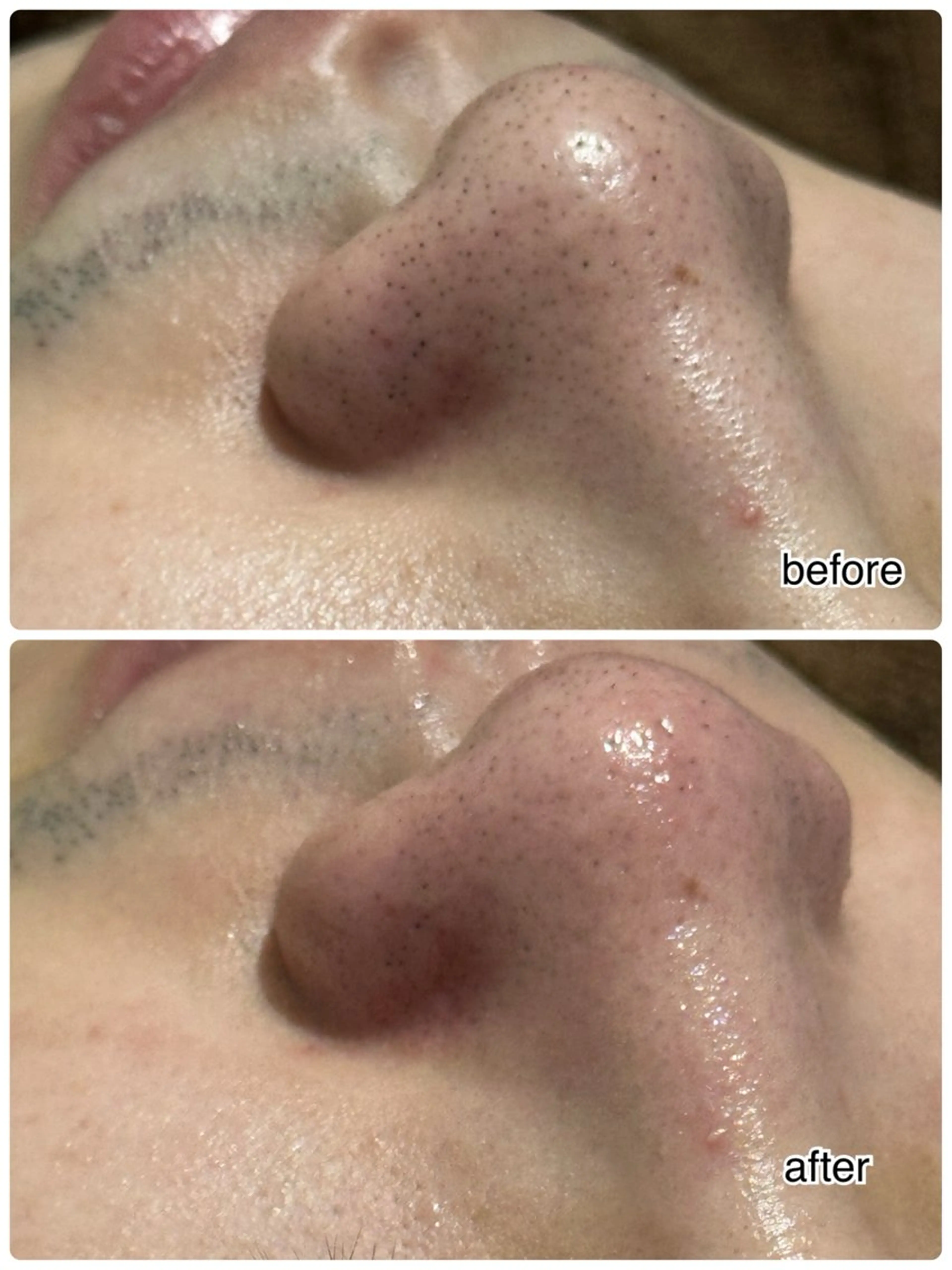 エステ ENCHANT 脱毛.小顔.毛穴のエステ・リラクイメージ