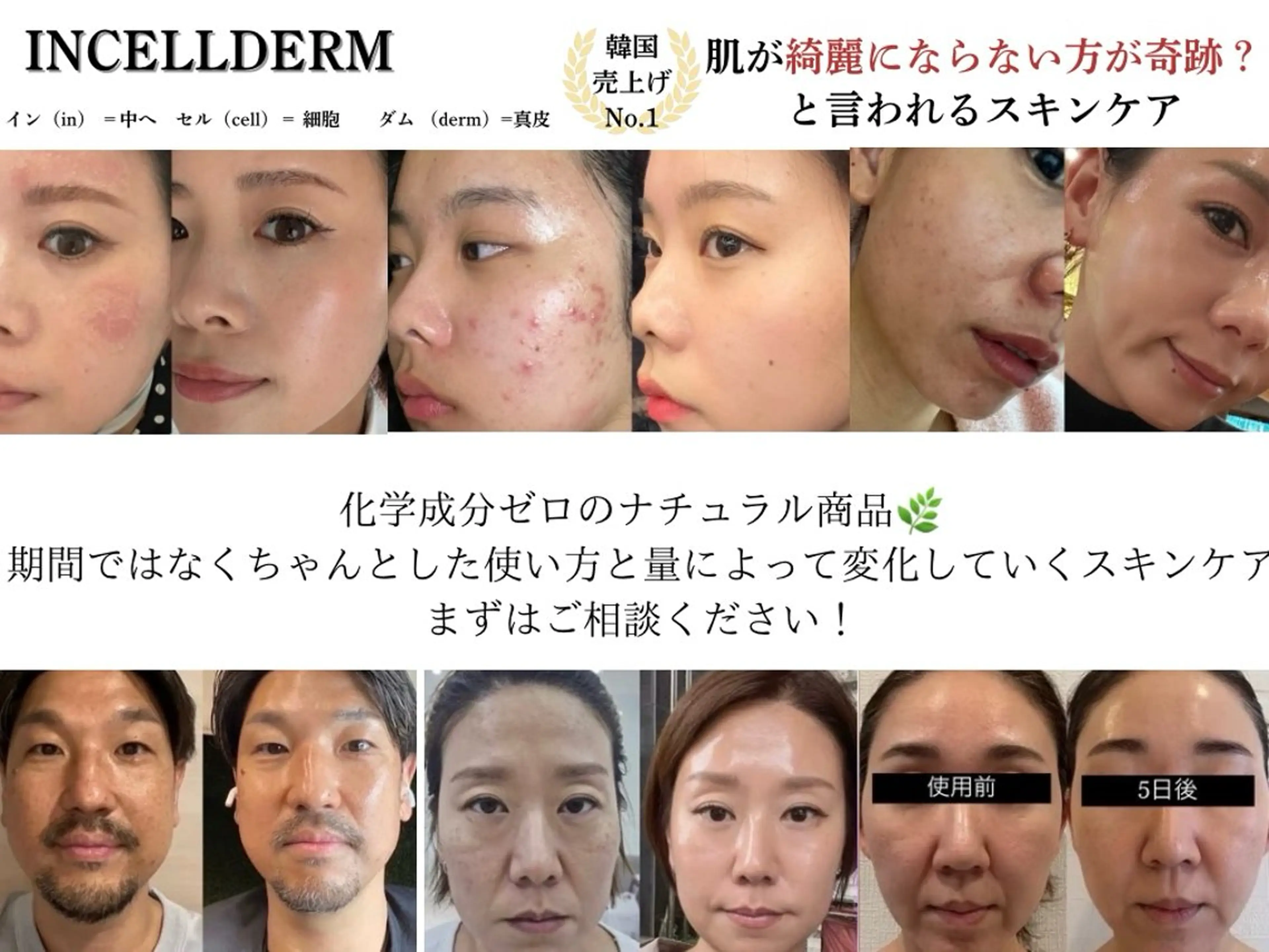 その他 【vidyto】ヴィディトゥ所属・肌管理サロン vidyto　MOEのその他イメージ