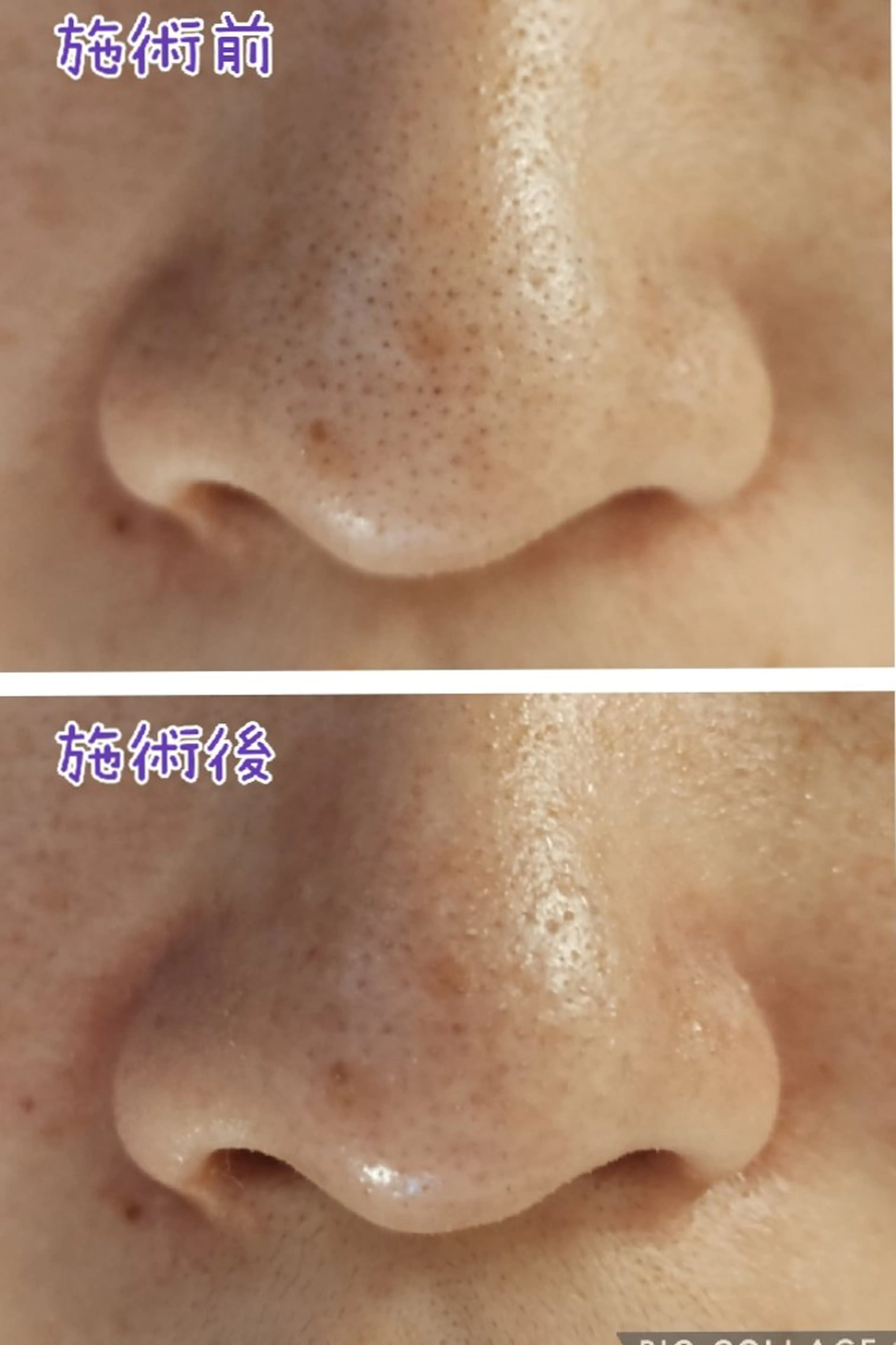 エステ beauty salon    向日葵所属・beauty  salon 向日葵のエステ・リラクイメージ