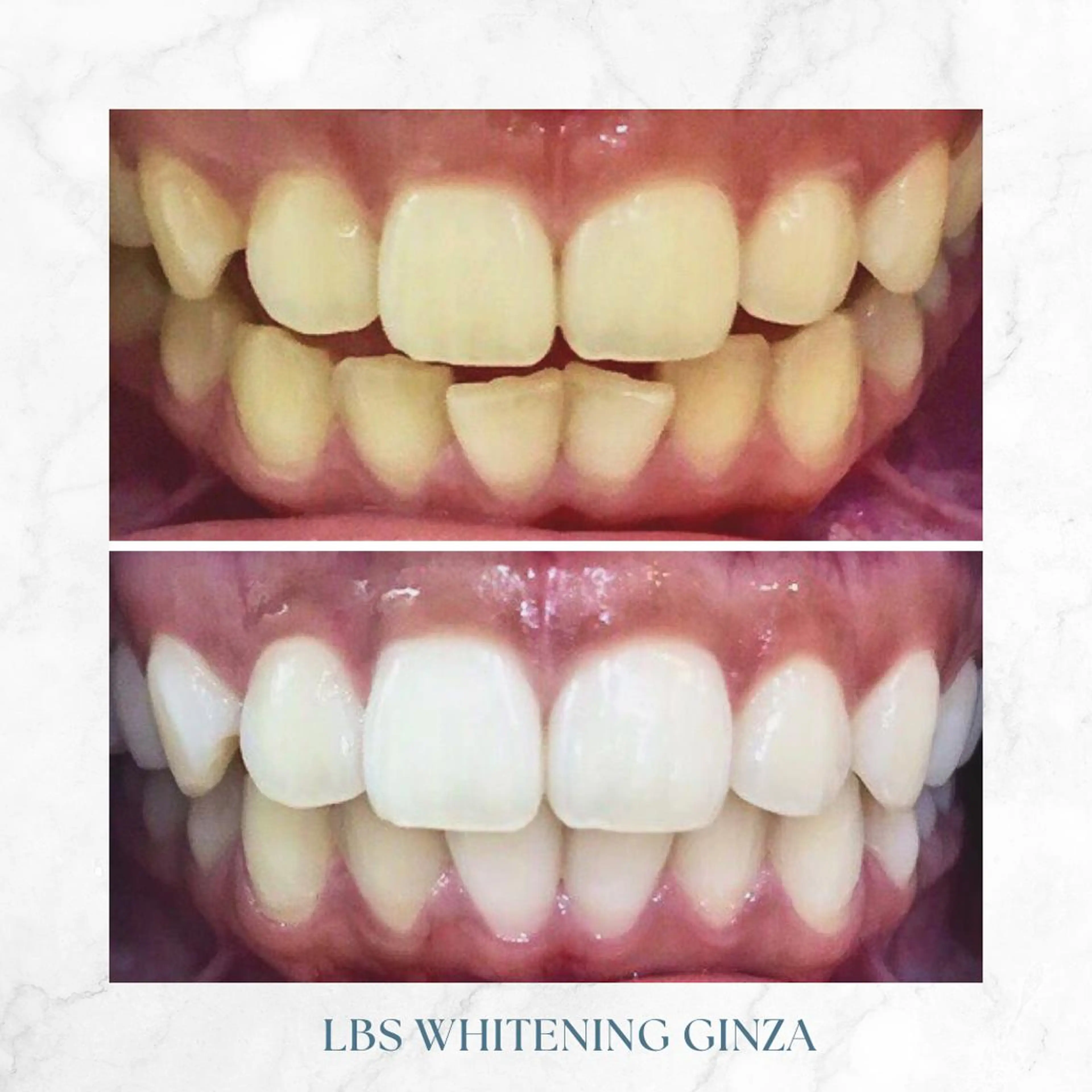 メンズ LBSホワイトニング 銀座店💎公式のその他イメージ