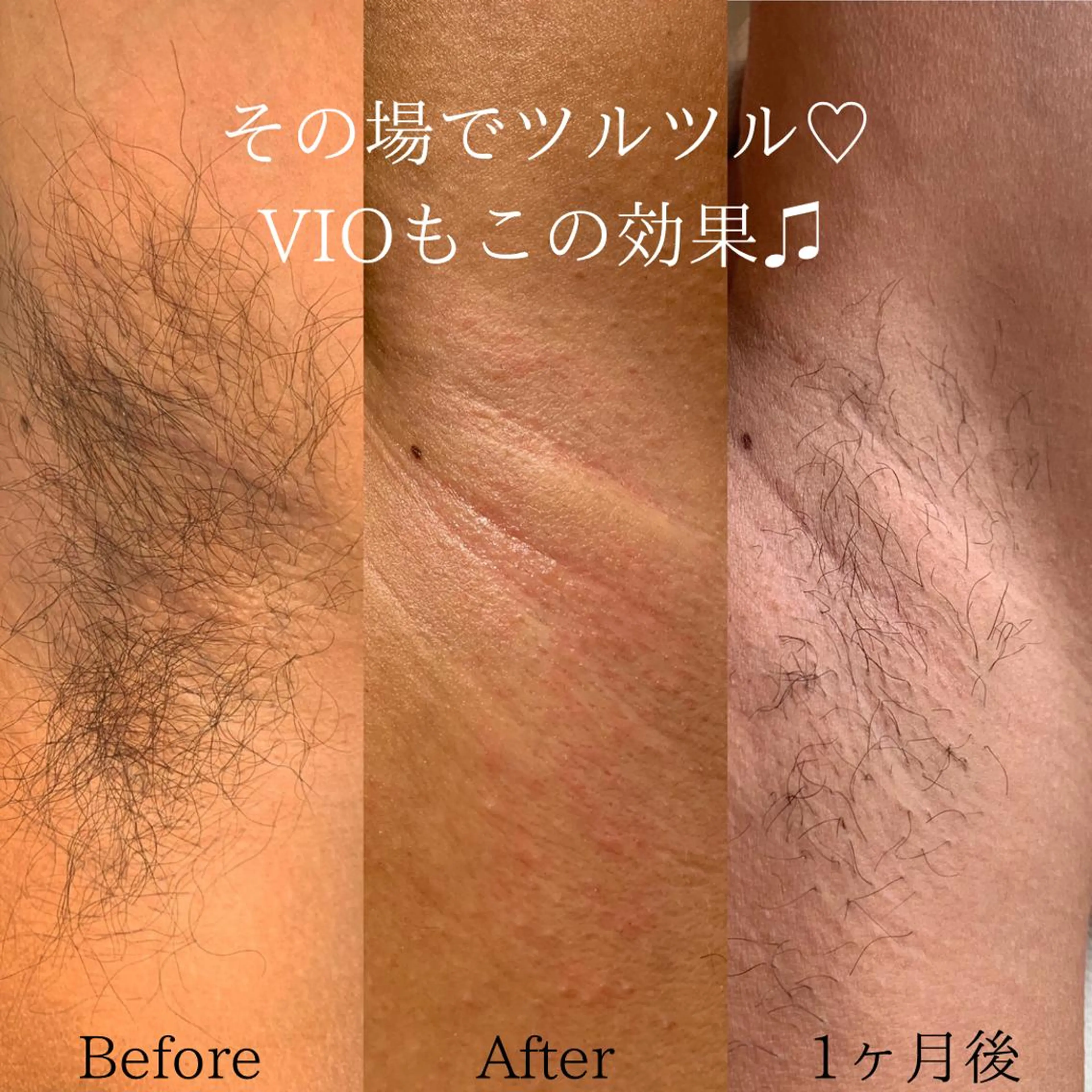 Jonai Azusaのエステ・リラクイメージ