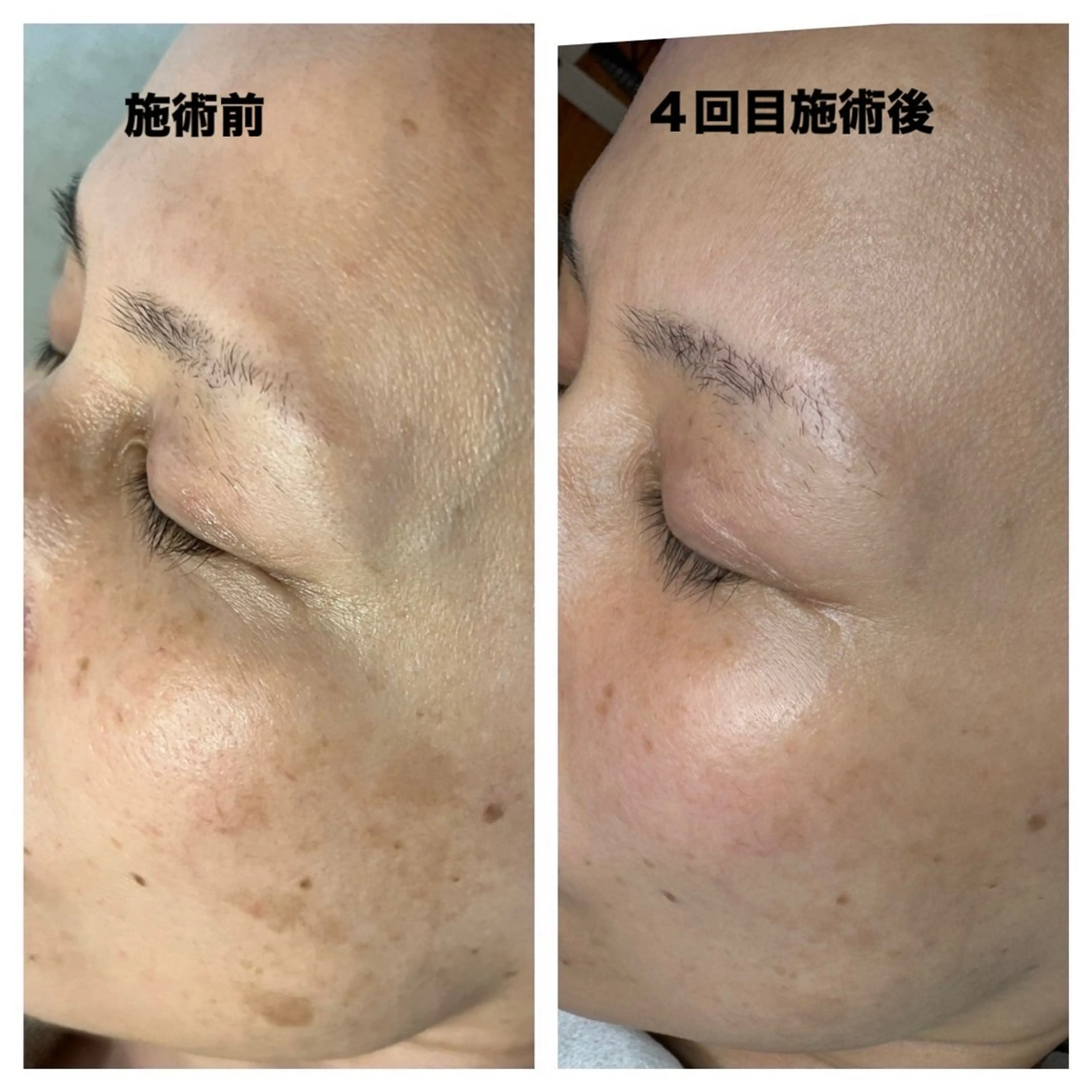 エステ スリーエスプラス内　美肌サロンEme所属・希映 -kieのエステ・リラクイメージ