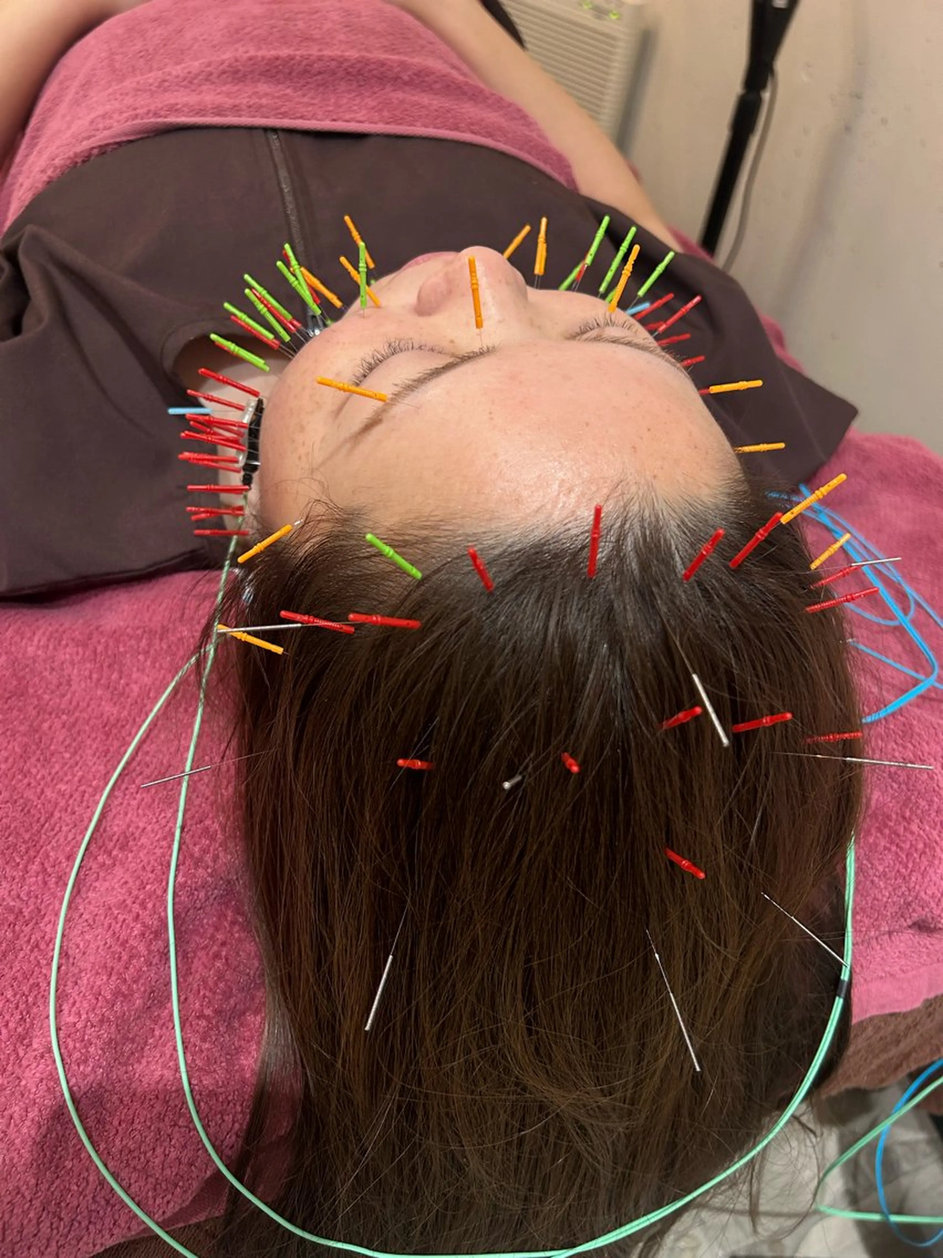 エステ リラク 美容鍼灸女性専用 りんご鍼灸治療院のその他イメージ