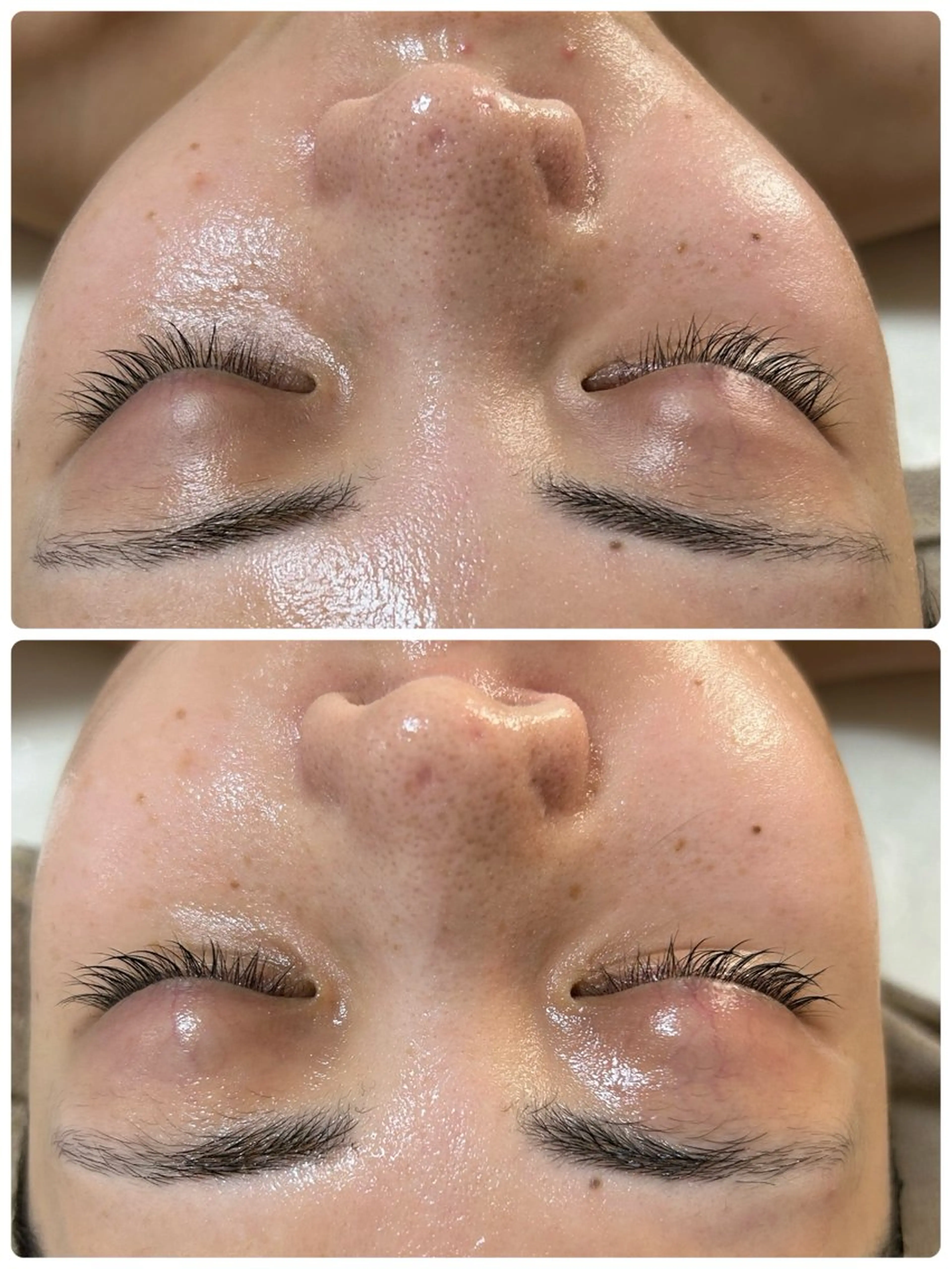 脱毛 Beauty salon Wish所属・脱毛🌈肌質改善🌈 Wishのエステ・リラクイメージ