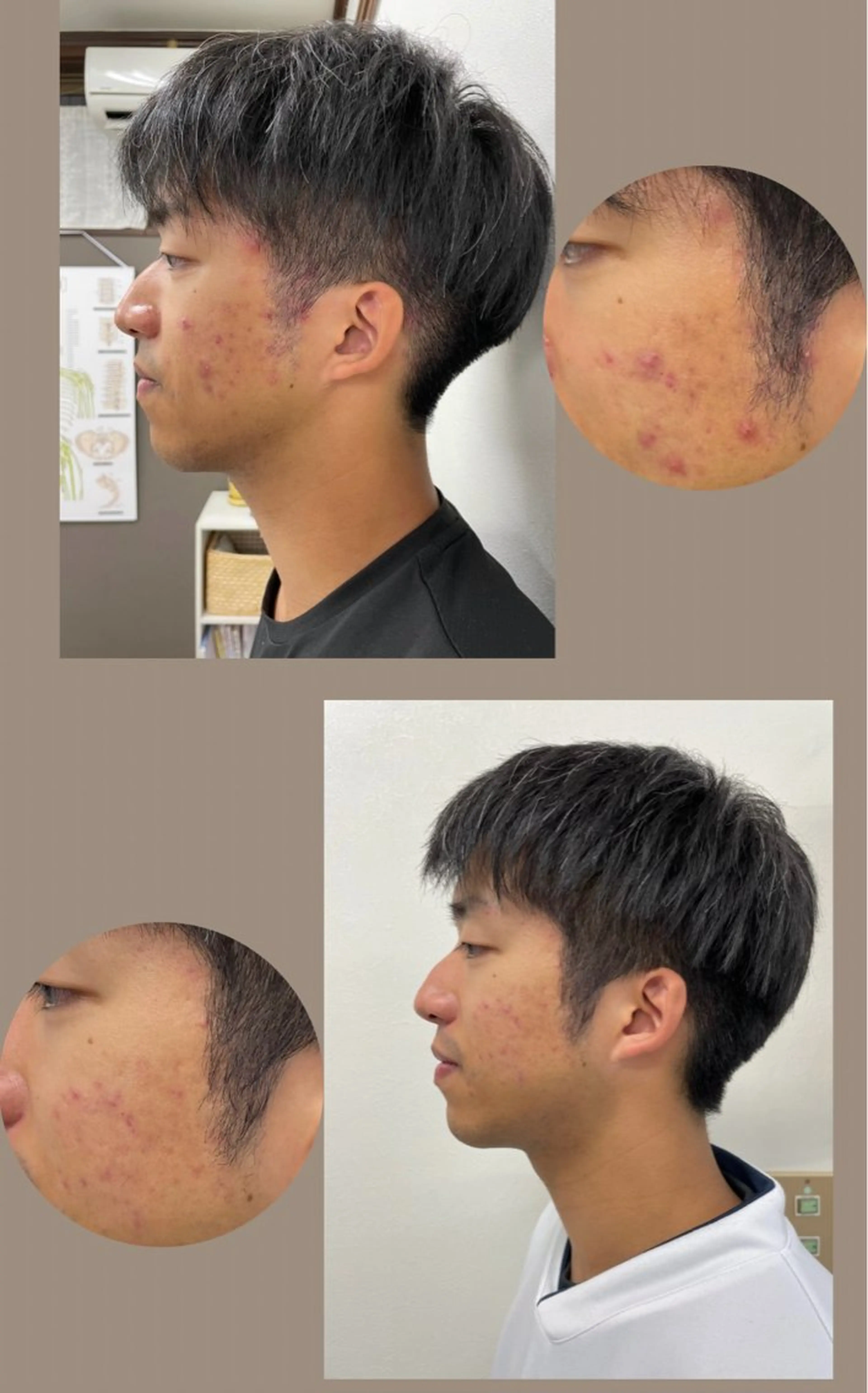 肌悩みのある方へ！スキンケア体験付き骨盤調整の写真