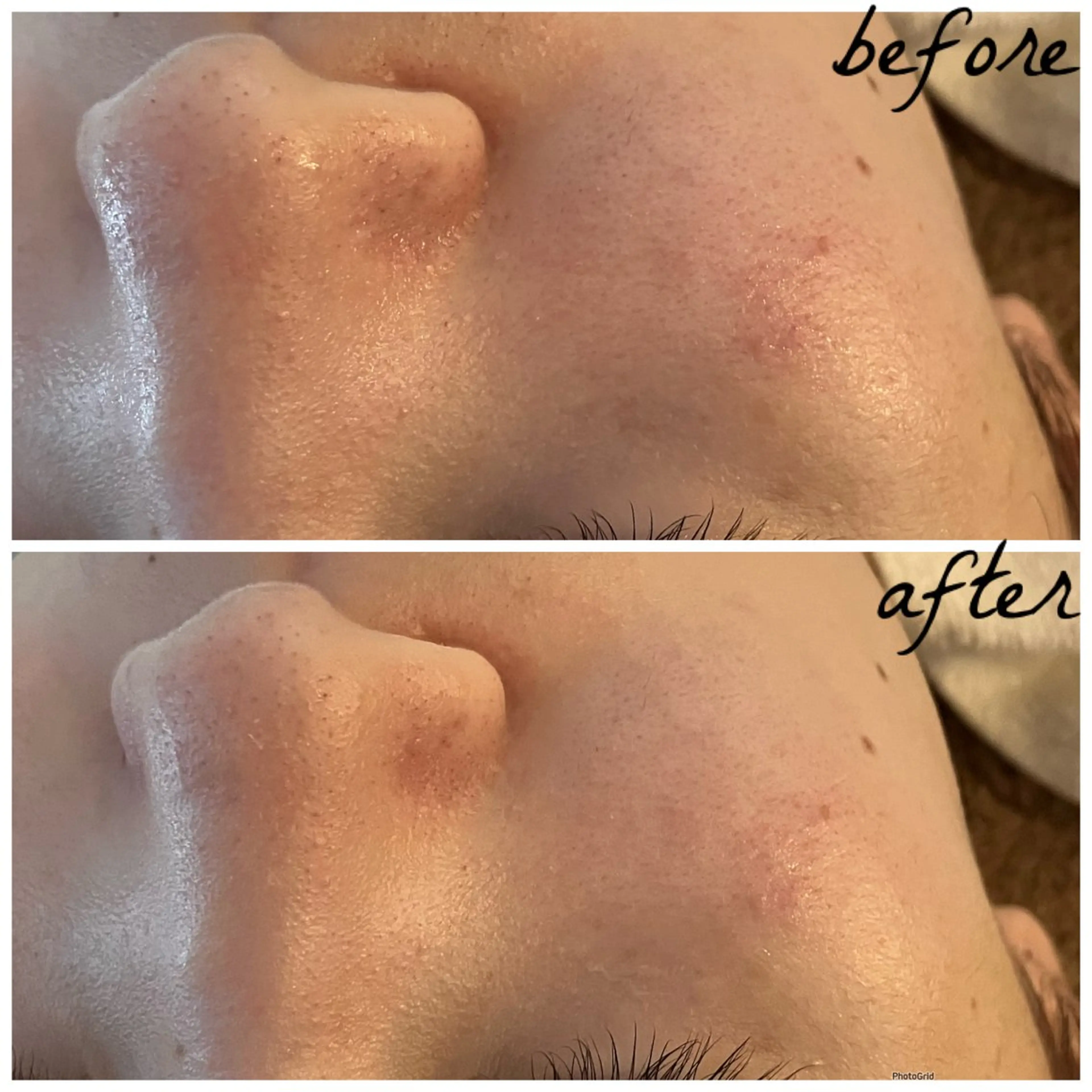 メンズ エステ メナード岐阜茜部 杉浦のエステ・リラクイメージ