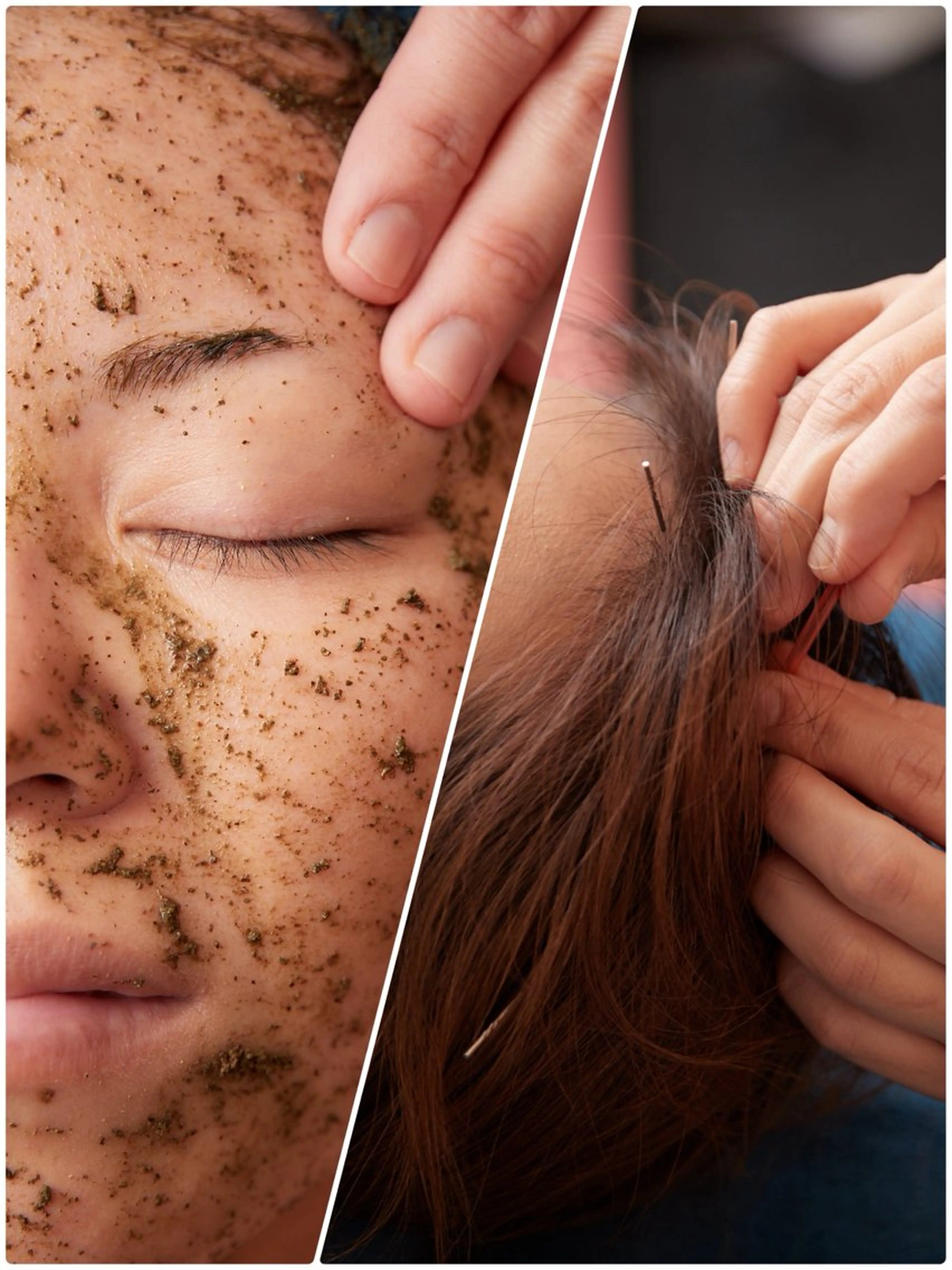 美楽鍼 びらくしんのその他イメージ