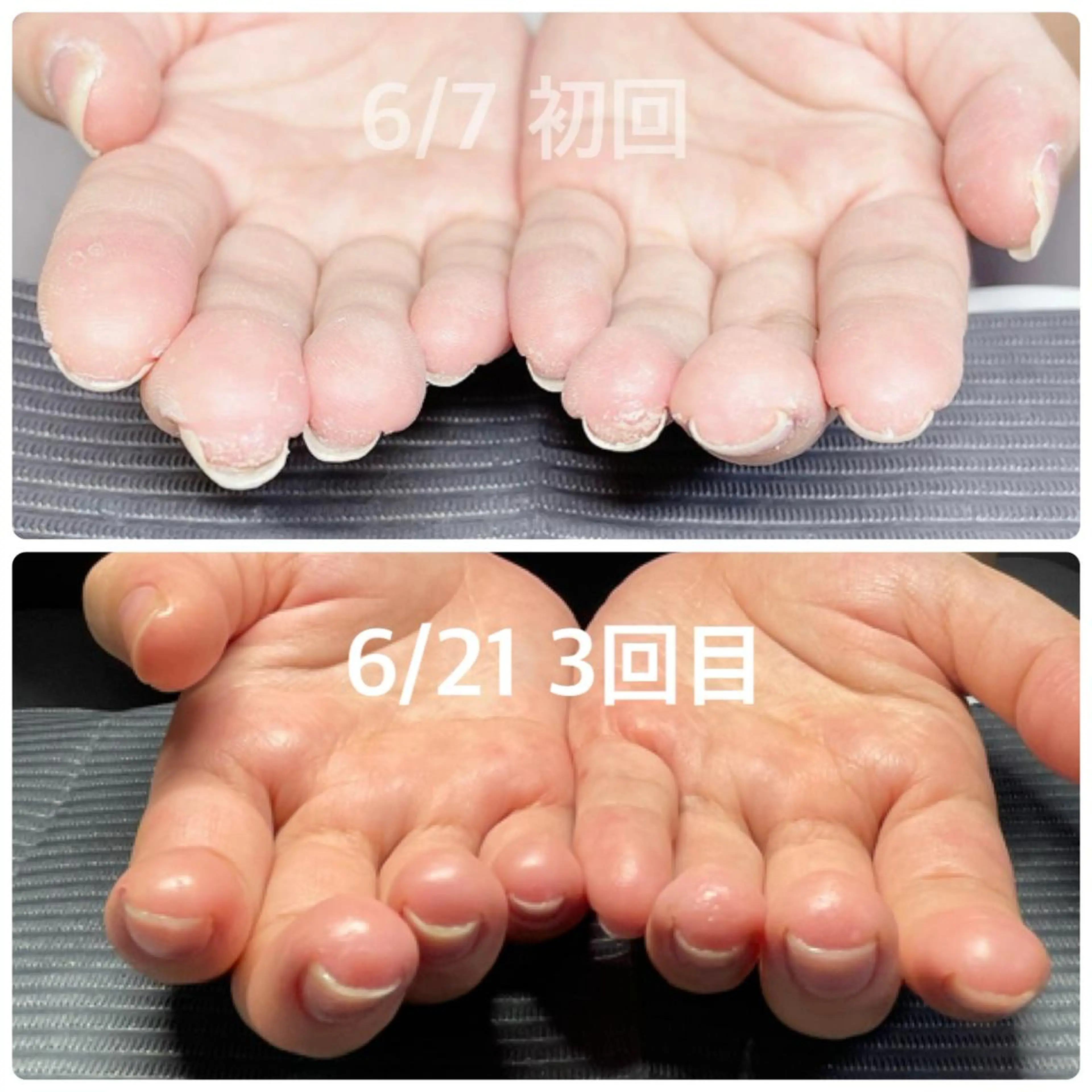 ネイル 奥園 良恵のネイルデザイン