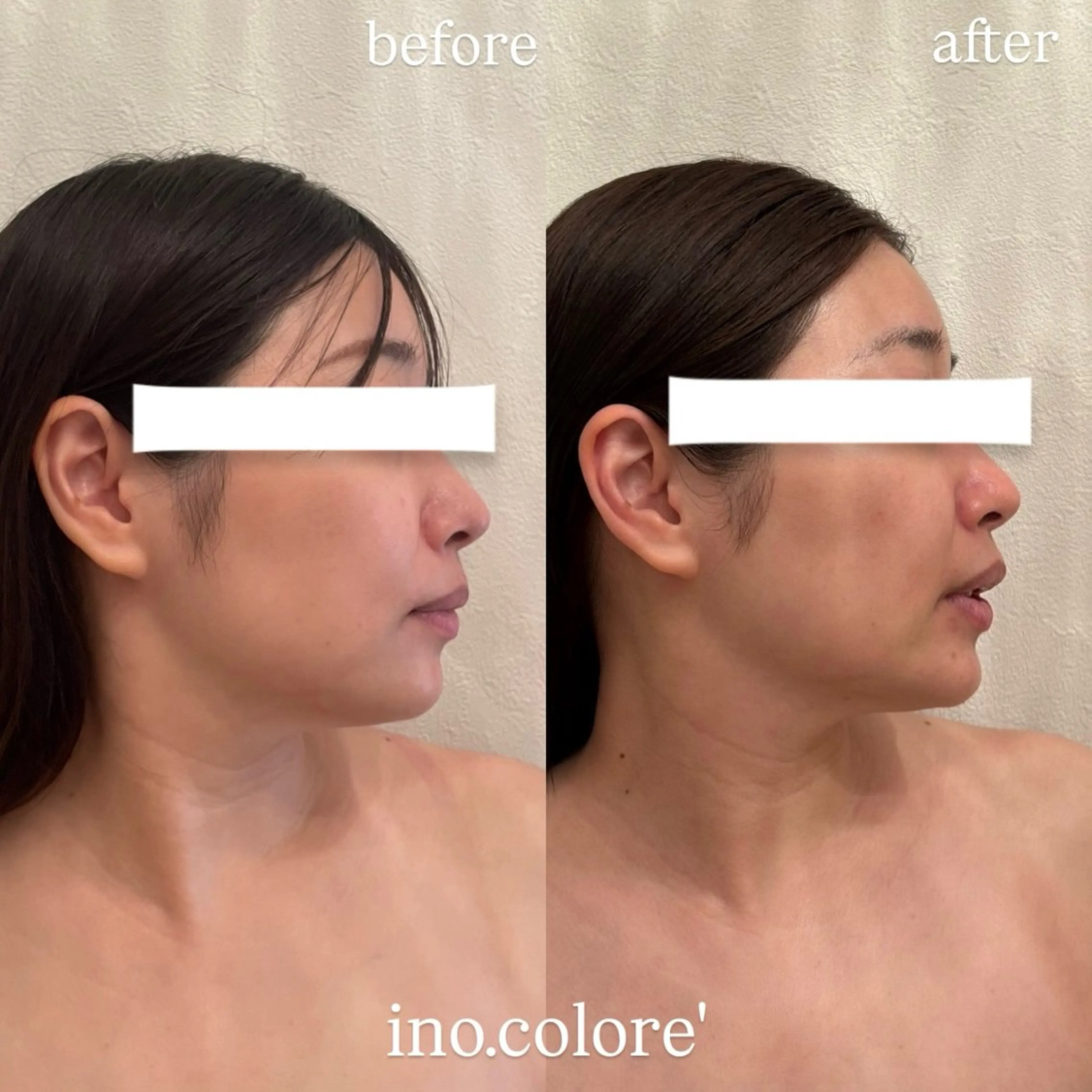 エステサロンino.colore'所属・小顔サロン ino.coloreのエステ・リラクイメージ