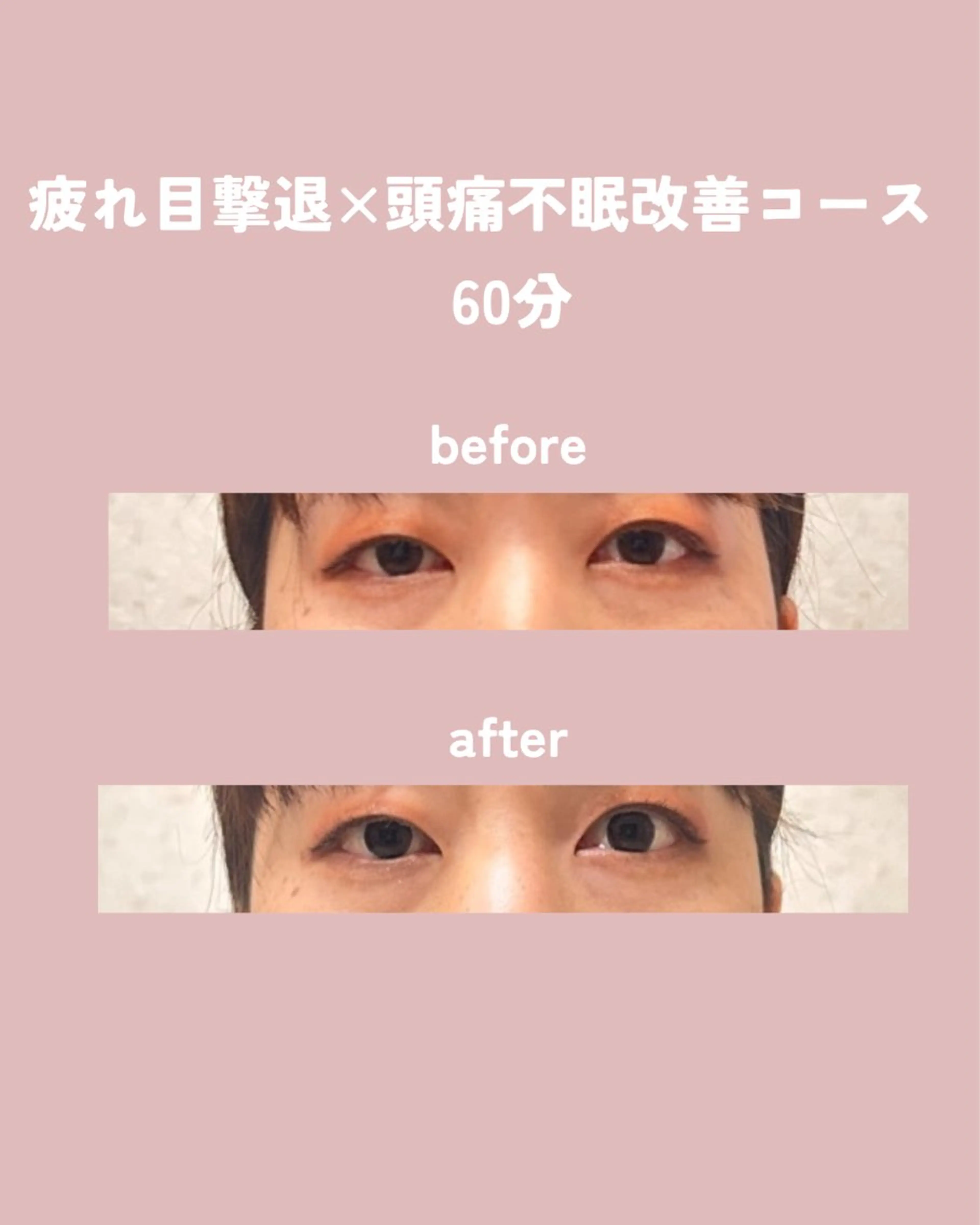 肩こり改善 専門店Fleuriのエステ・リラクイメージ