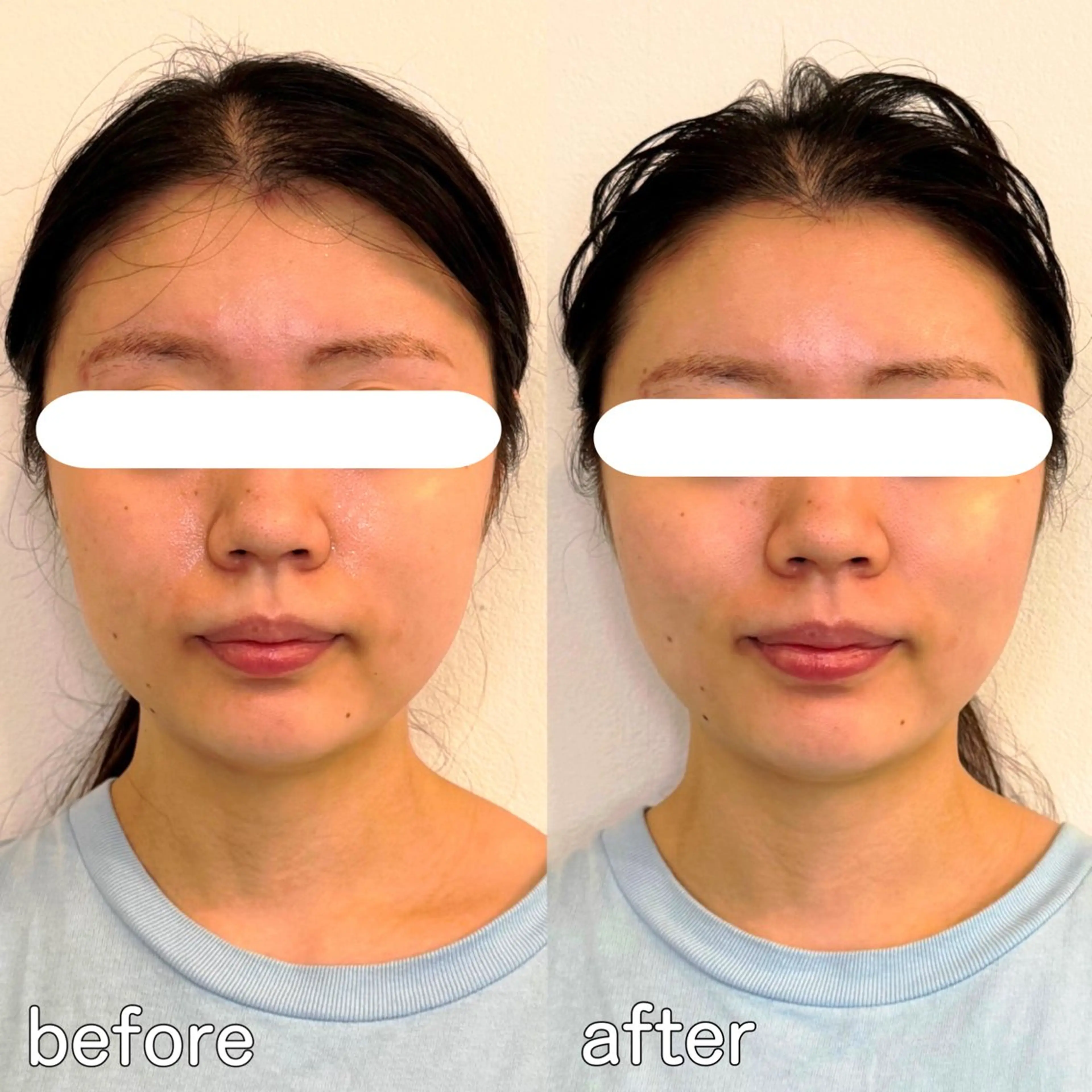 小顔矯正&美容整体 整え屋REDオーナーのエステ・リラクイメージ