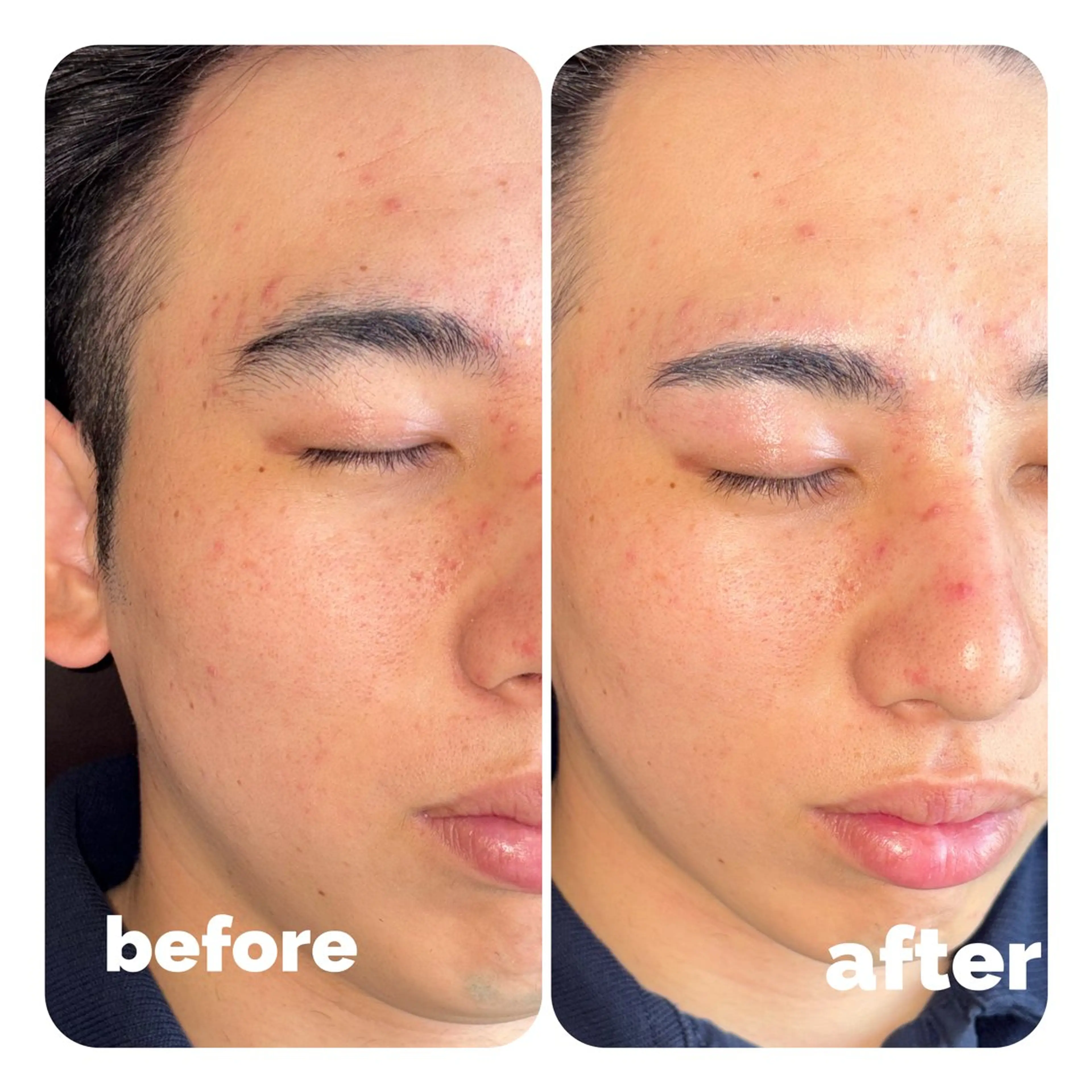 アイブロウ ハリウッドブロウリフト メンズアイブロウ 眉毛ワックス脱毛 ワックス脱毛 LAND🫧🎀 Ayakaの眉毛・アイブロウイメージ