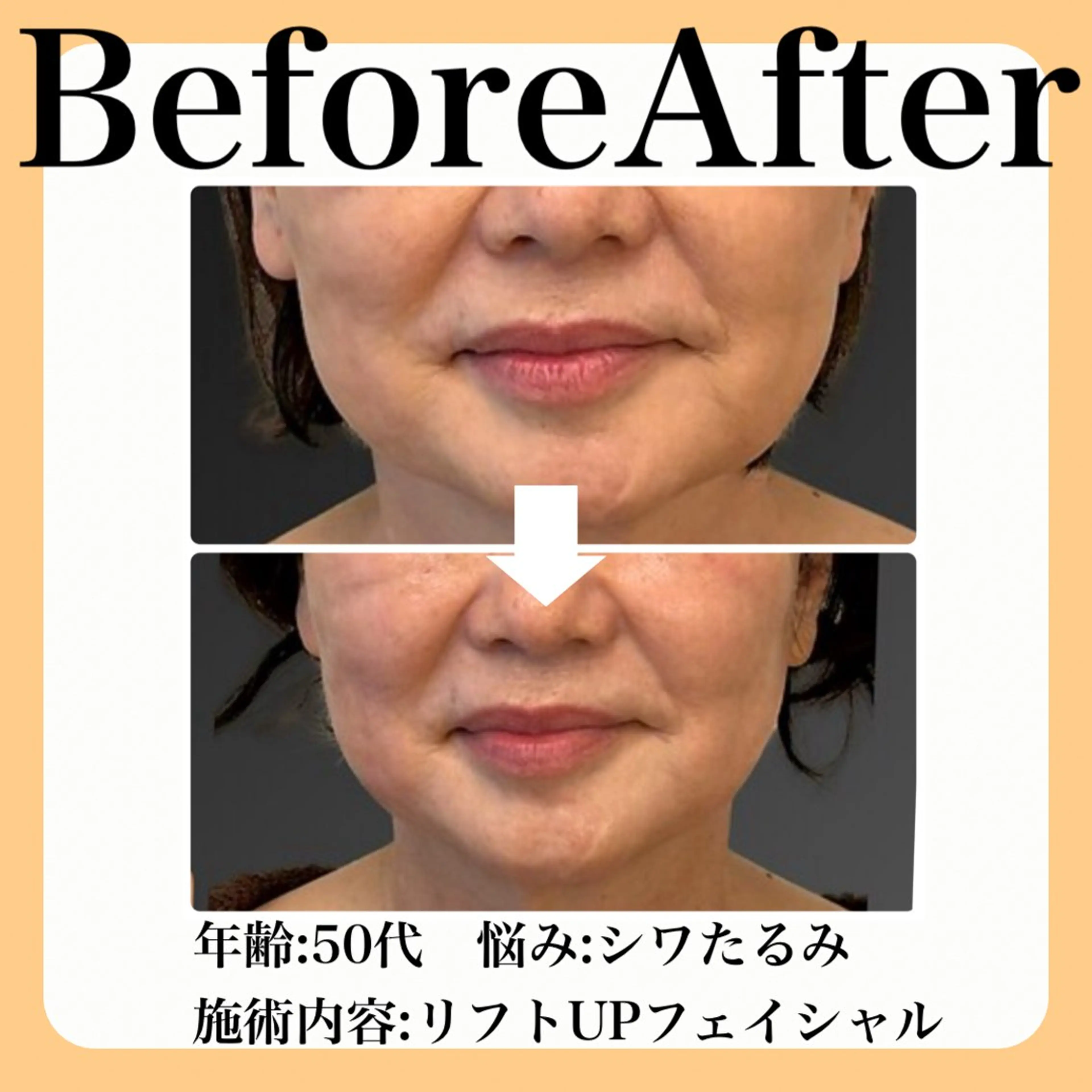 エステ 毛穴・たるみ･ニキビケア専門サロンsui所属・sui【スイ】 ARISAのエステ・リラクイメージ