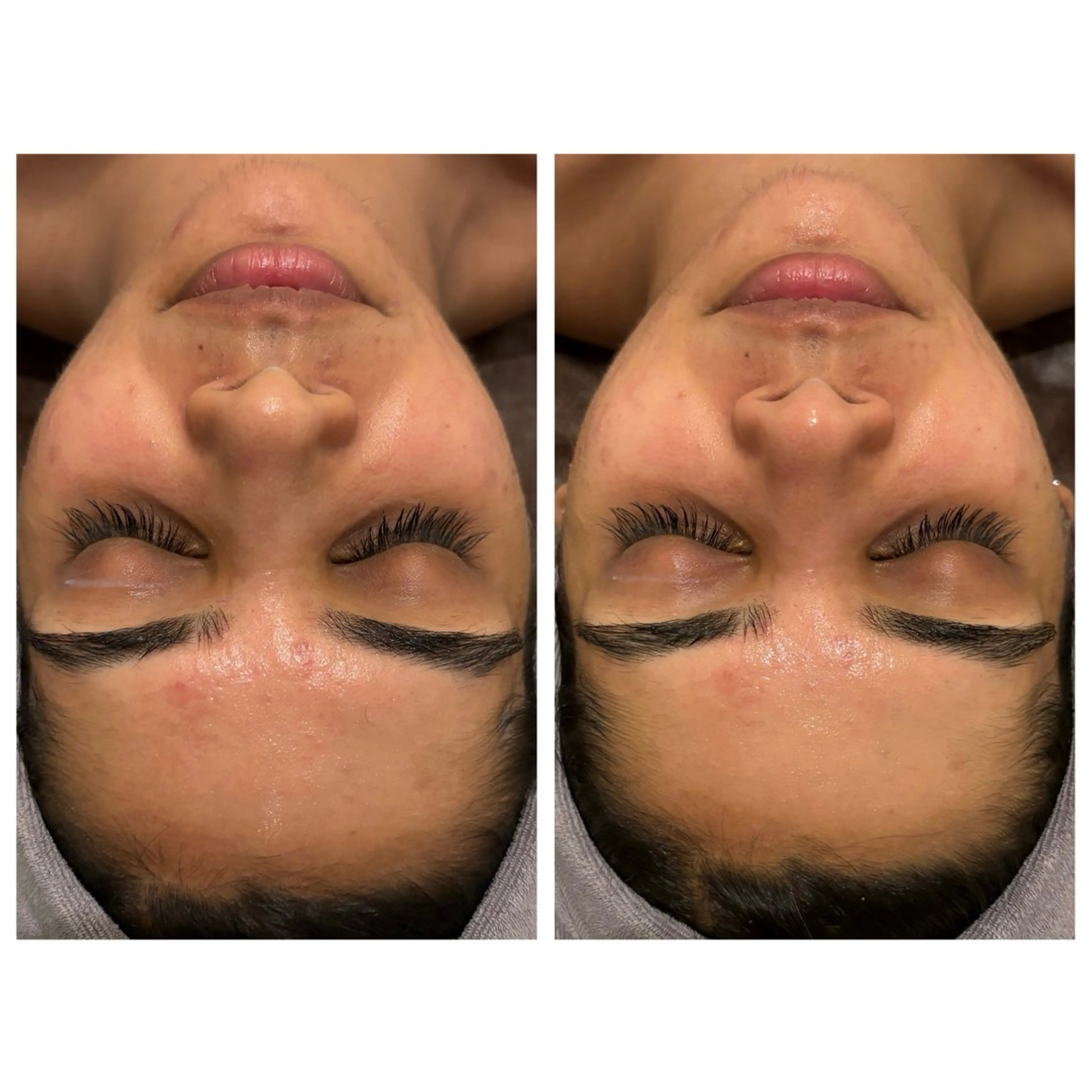 小顔コルギ ☆表参道/外苑前のエステ・リラクイメージ