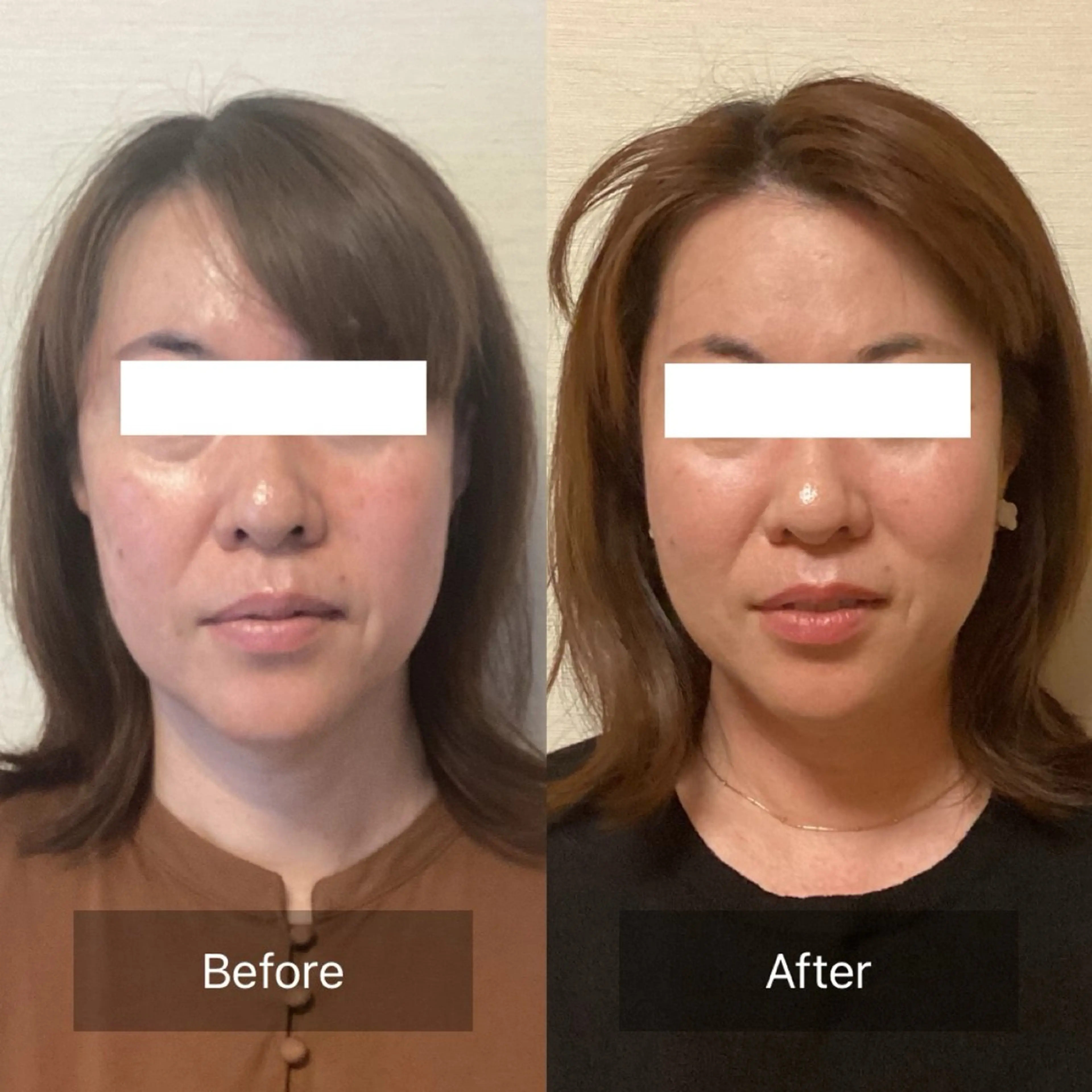 エステ リラク ルコナビューティ所属・小顔・歪み専門　井元 朋子のエステ・リラクイメージ