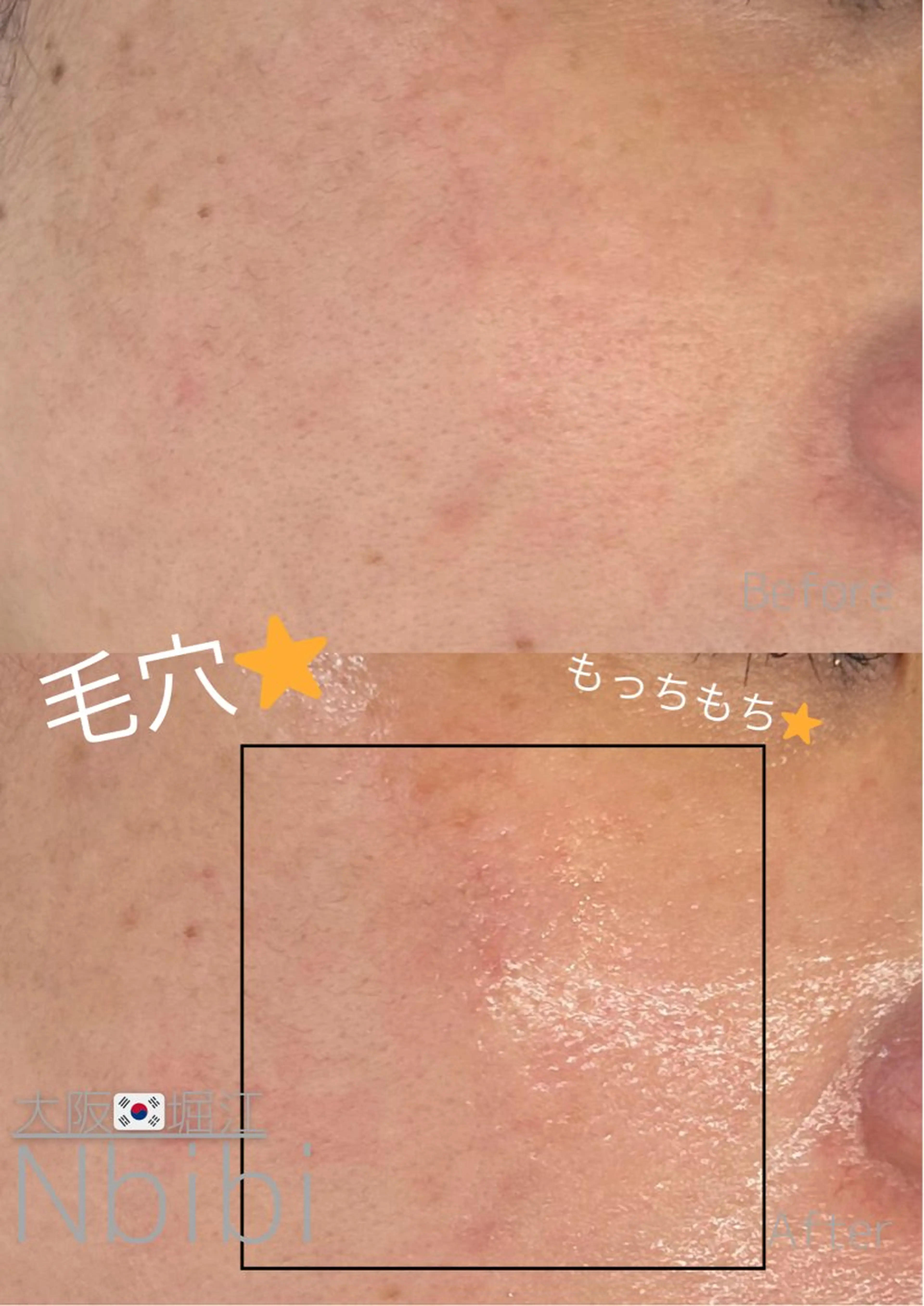 エステ 韓国🇰🇷価格 サロン_Nbibiのエステ・リラクイメージ