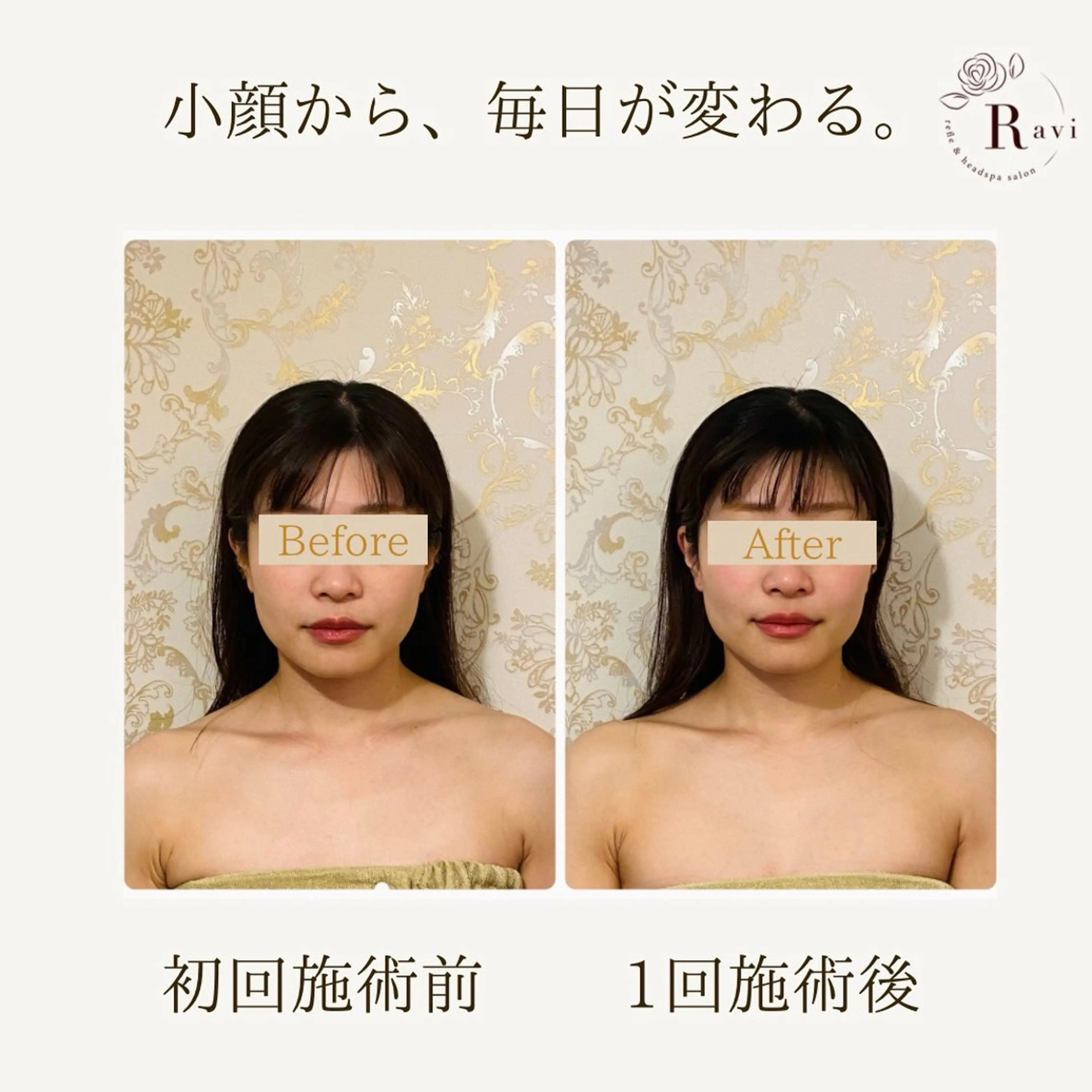 小顔サロンラヴィ　　船橋馬込沢店所属・小顔サロンラヴィ 船橋のエステ・リラクイメージ