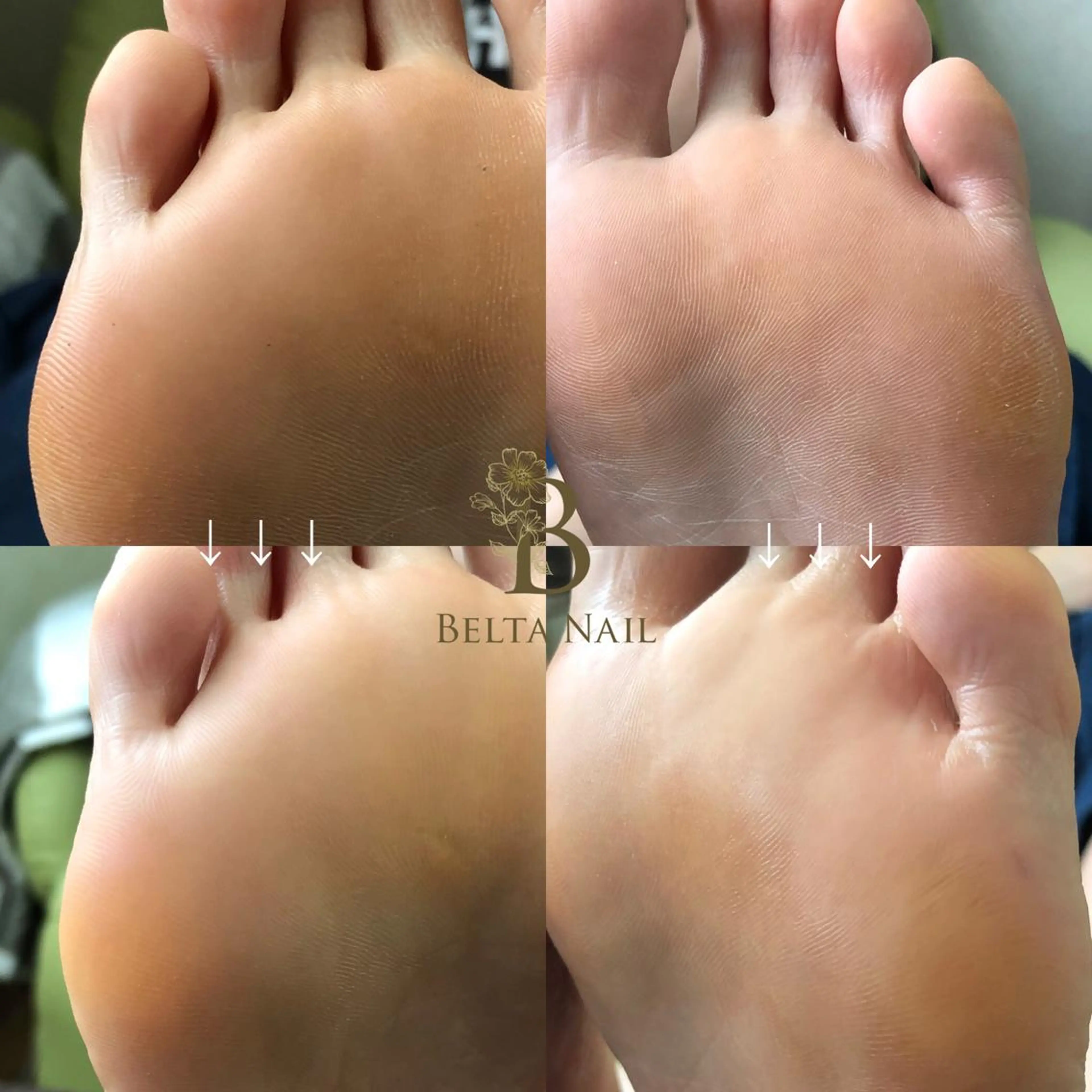 ネイル その他(ネイル) BELTA NAILのネイルデザイン