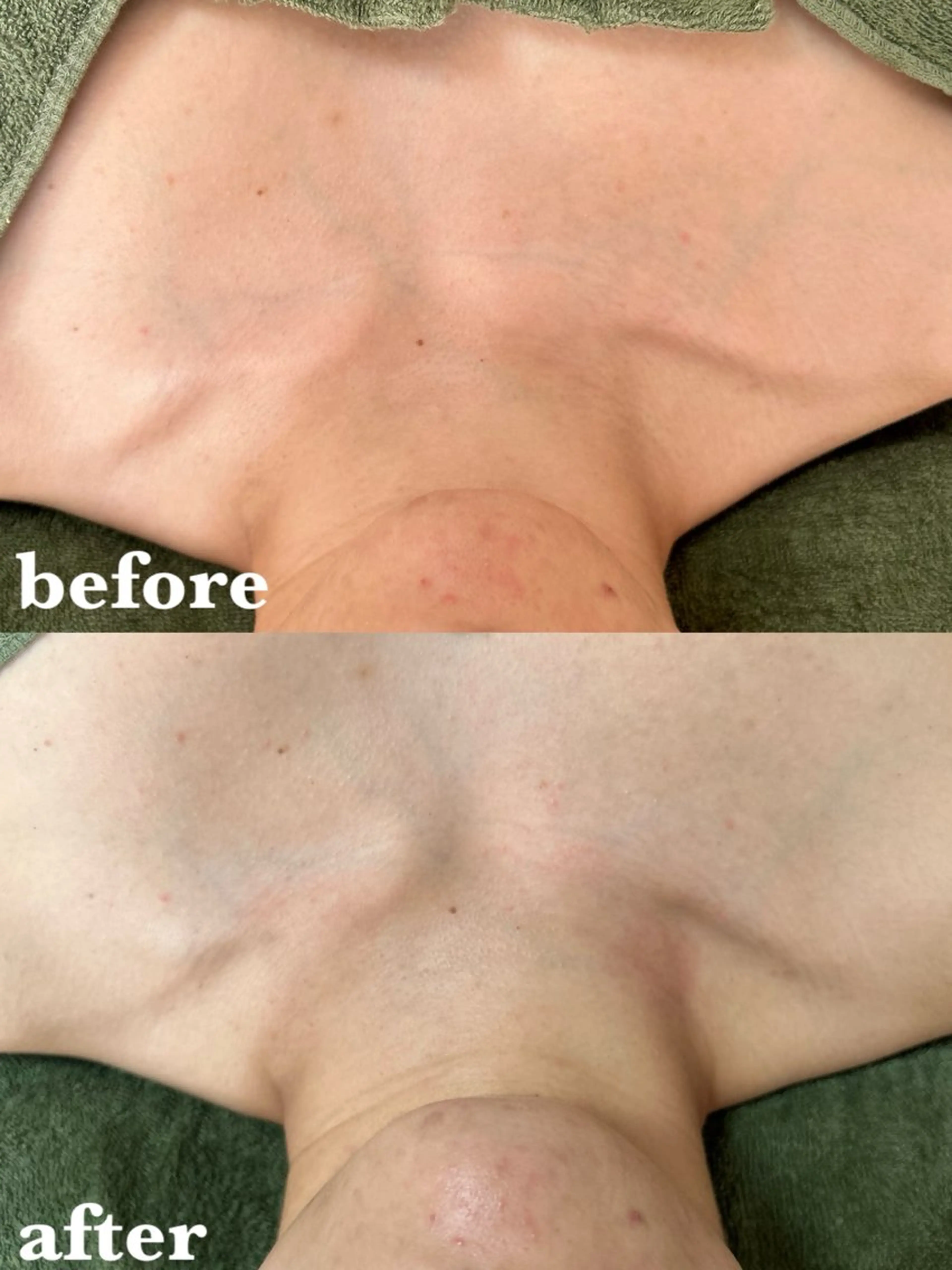 エステ リラク 【肌質改善サロン】 リーフィアのエステ・リラクイメージ