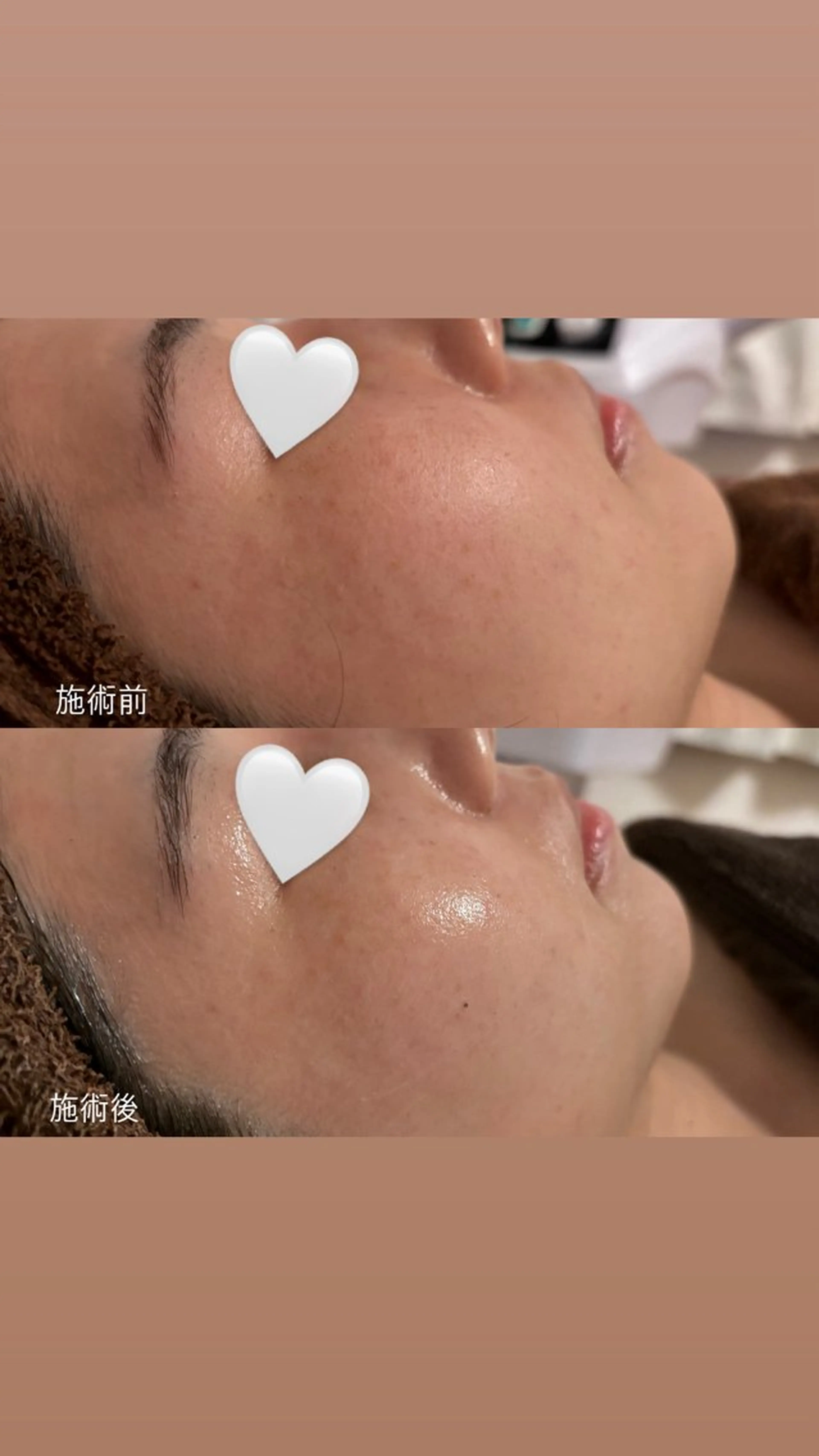 mison所属・mison 安形友花のネイルデザイン