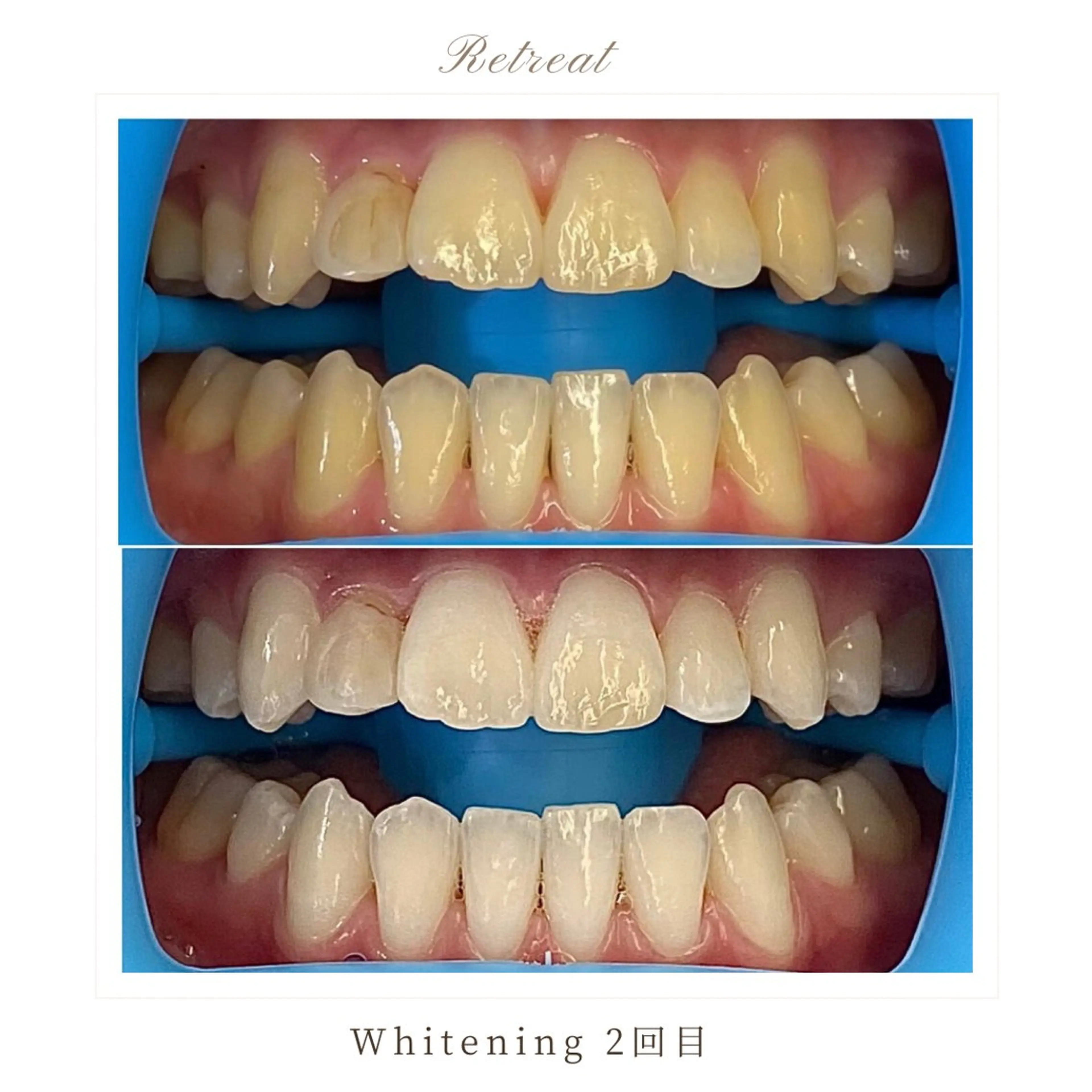 Retreatリトリート所属・歯科医院提携 Retreatのエステ・リラクイメージ