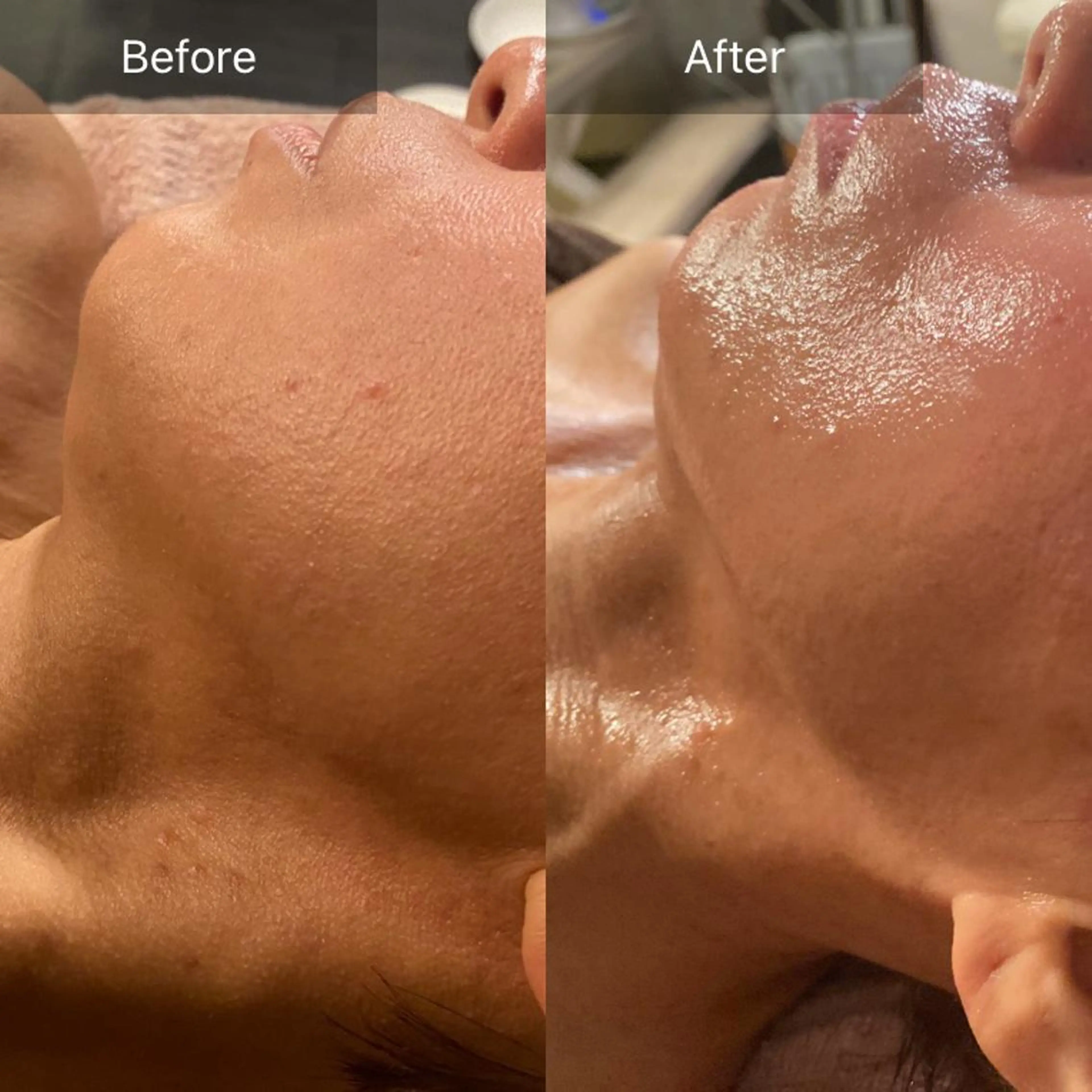 Mandarin Orange所属・毛穴から始める肌メン テマンダリンオレンジのエステ・リラクイメージ