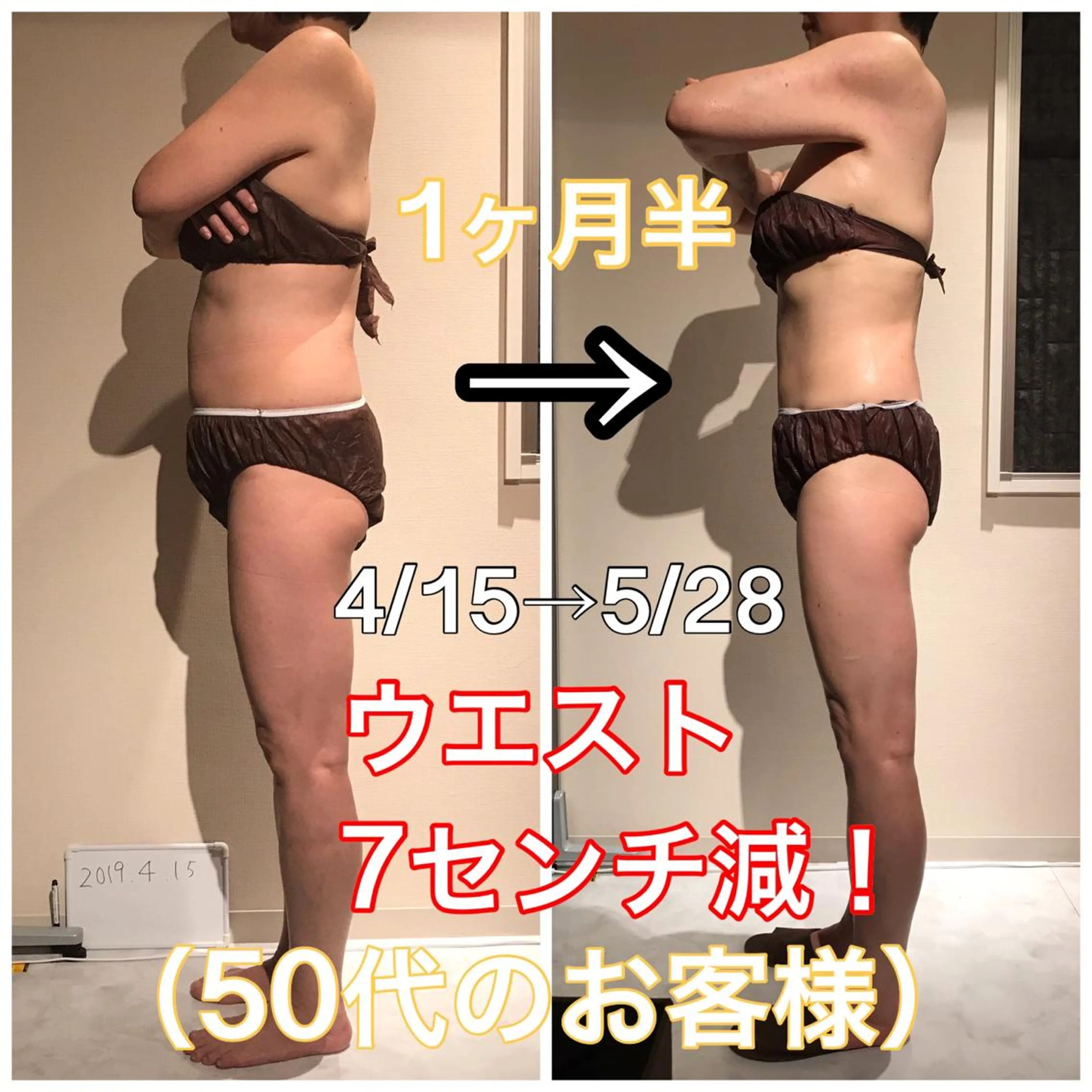 【カスタマイズ痩身120】強圧ハンド＆セル撃退マシンで効果実感◎人気のダイエットメニュー★くびれ、脚痩せ、二の腕痩せ★の写真