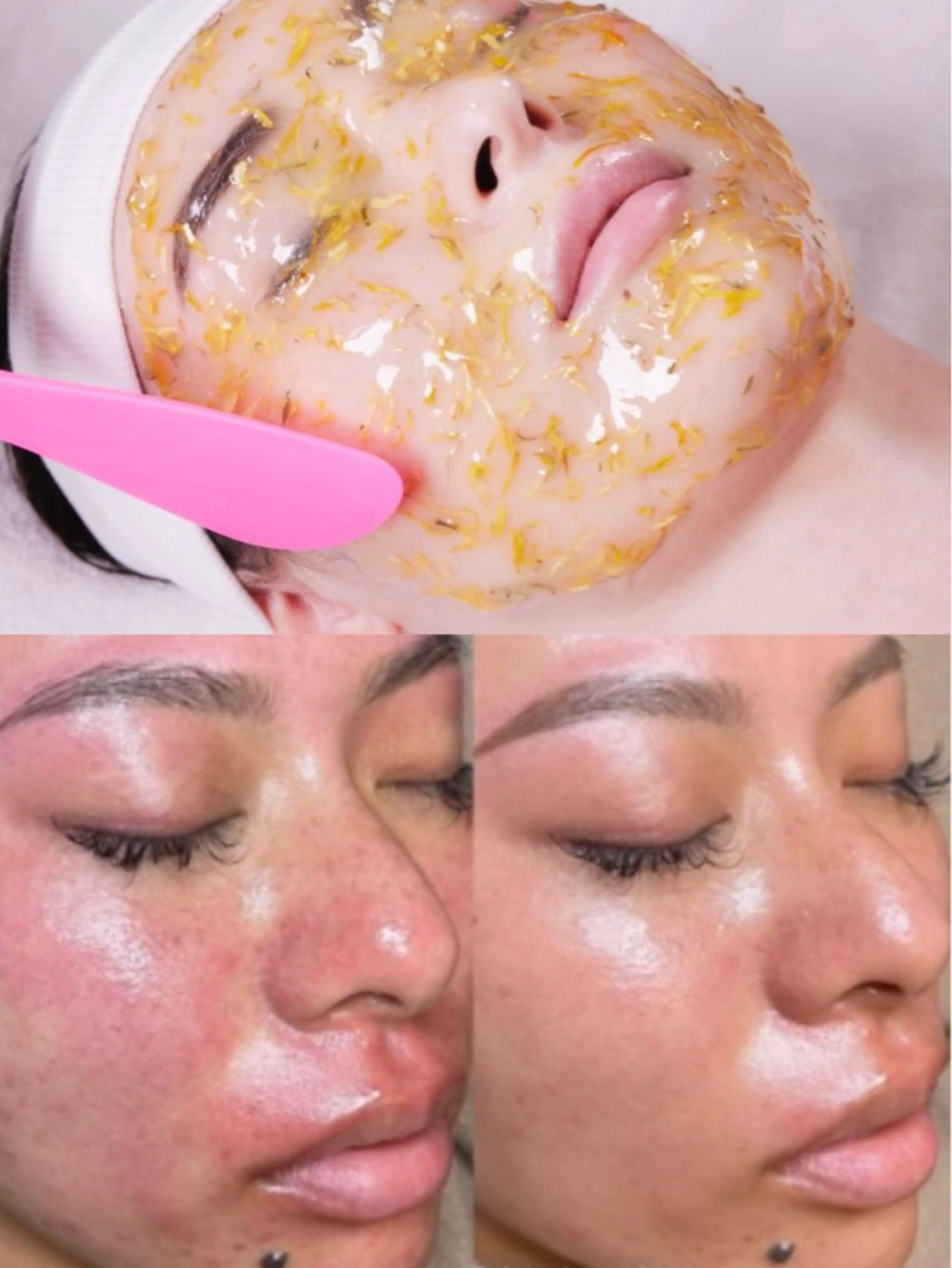 毛穴洗浄×顔ツボトリートメント×ハイドロジェリー/スピン肌ケア60分¥17980→7480の写真