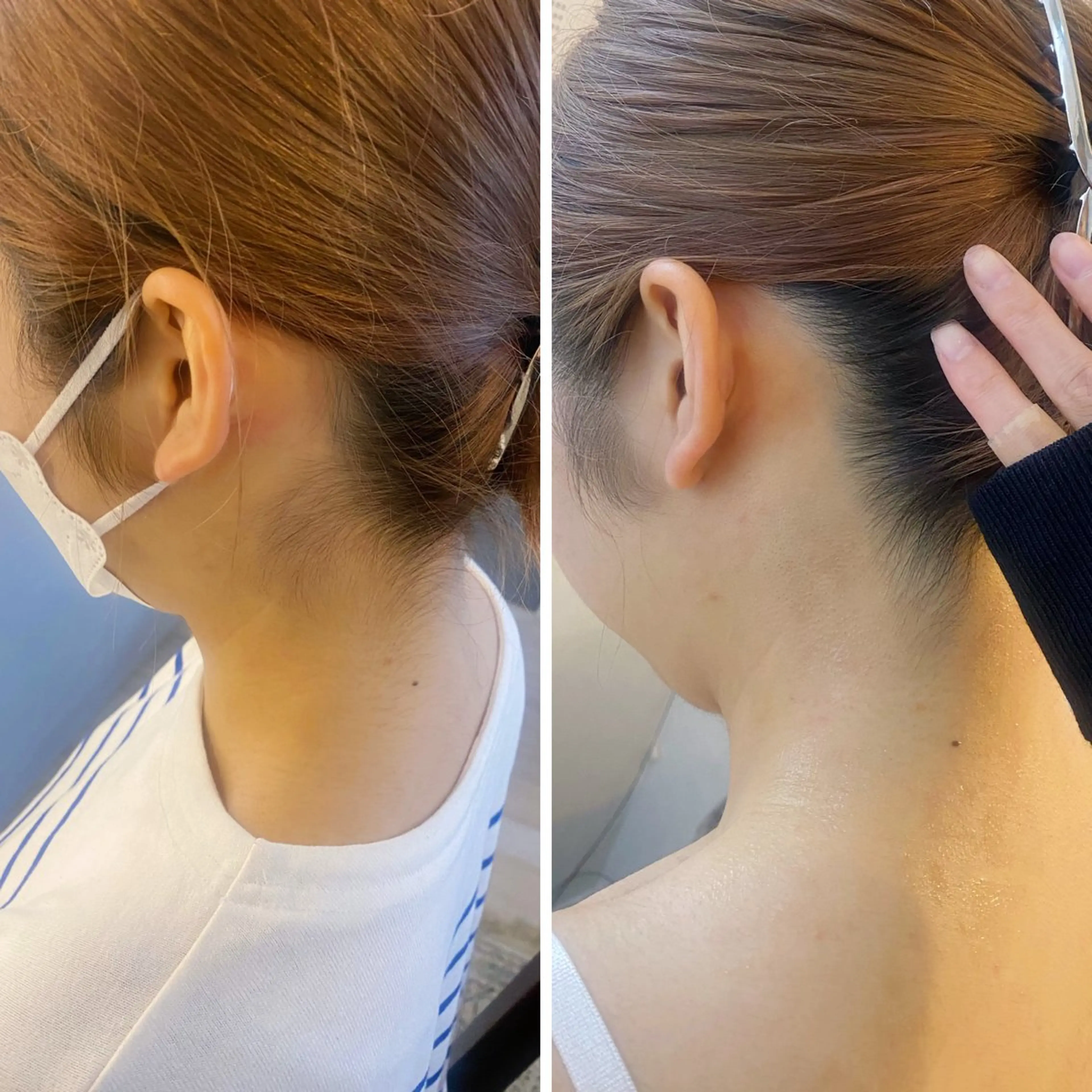 脱毛 うなじ脱毛/美肌脱毛 LABELのエステ・リラクイメージ