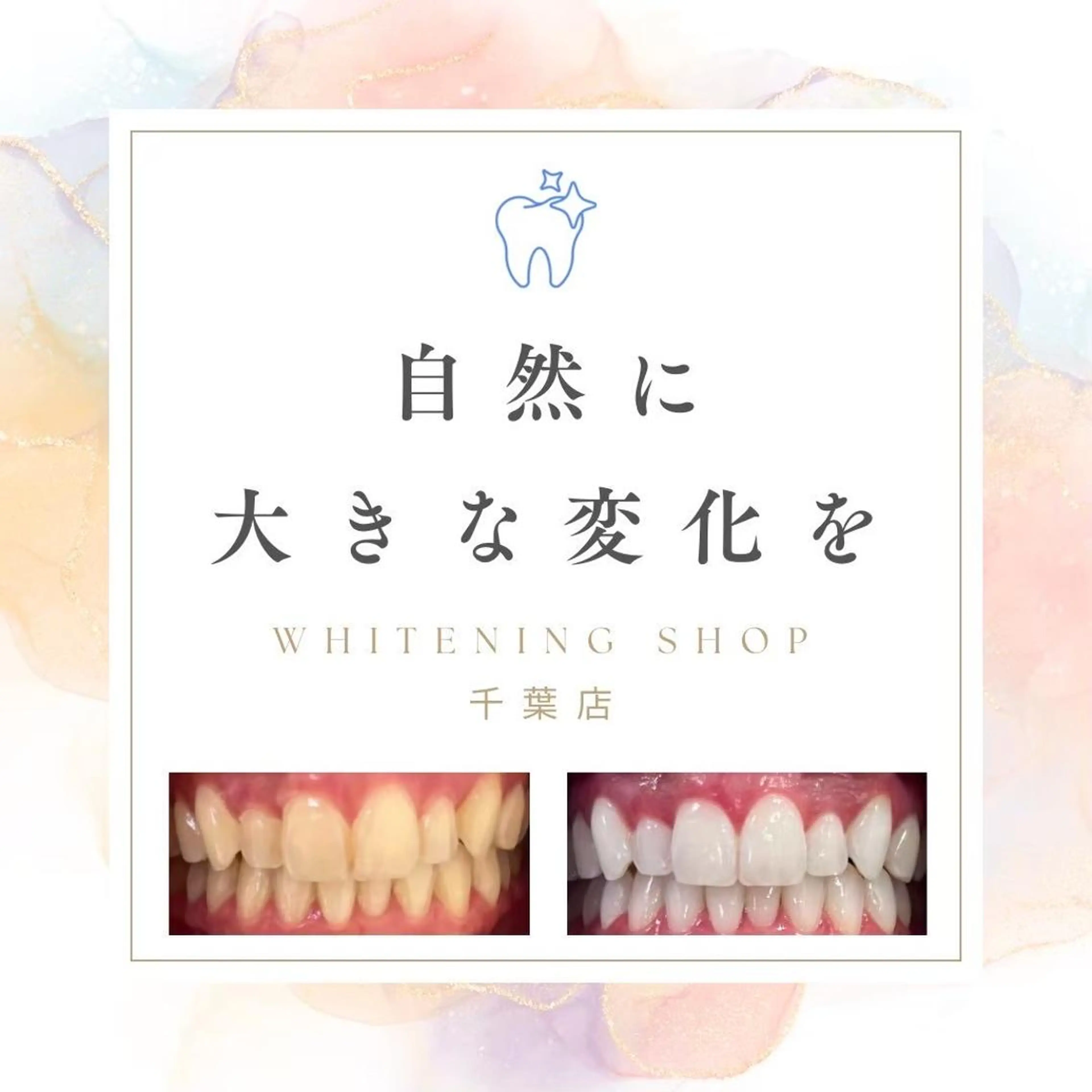 メンズ その他 ホワイトニング ショップ千葉店のその他イメージ