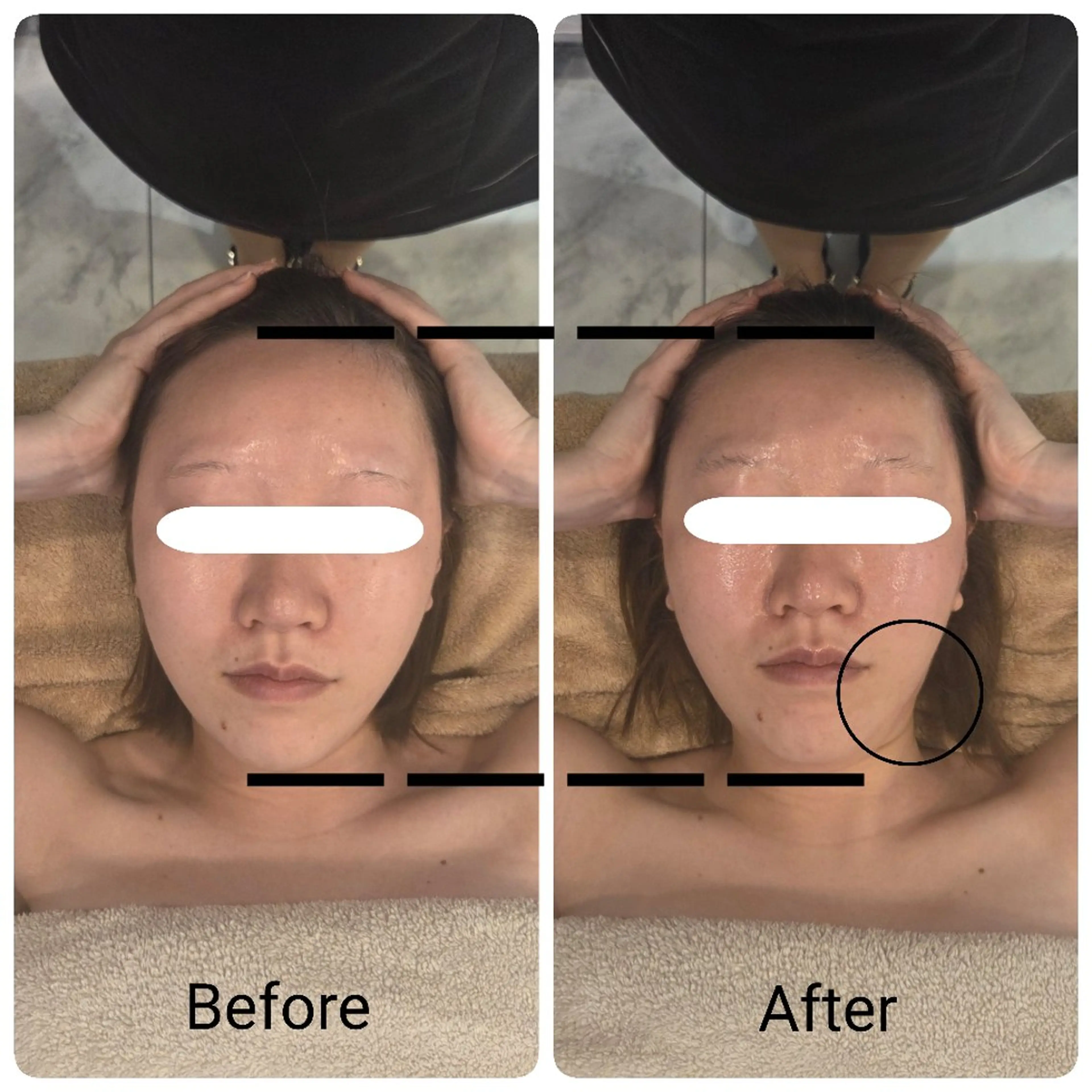 【学割U24】乾燥,毛穴,小顔,リフトアップ 45分2回コース ￥24,980→￥9,800の写真